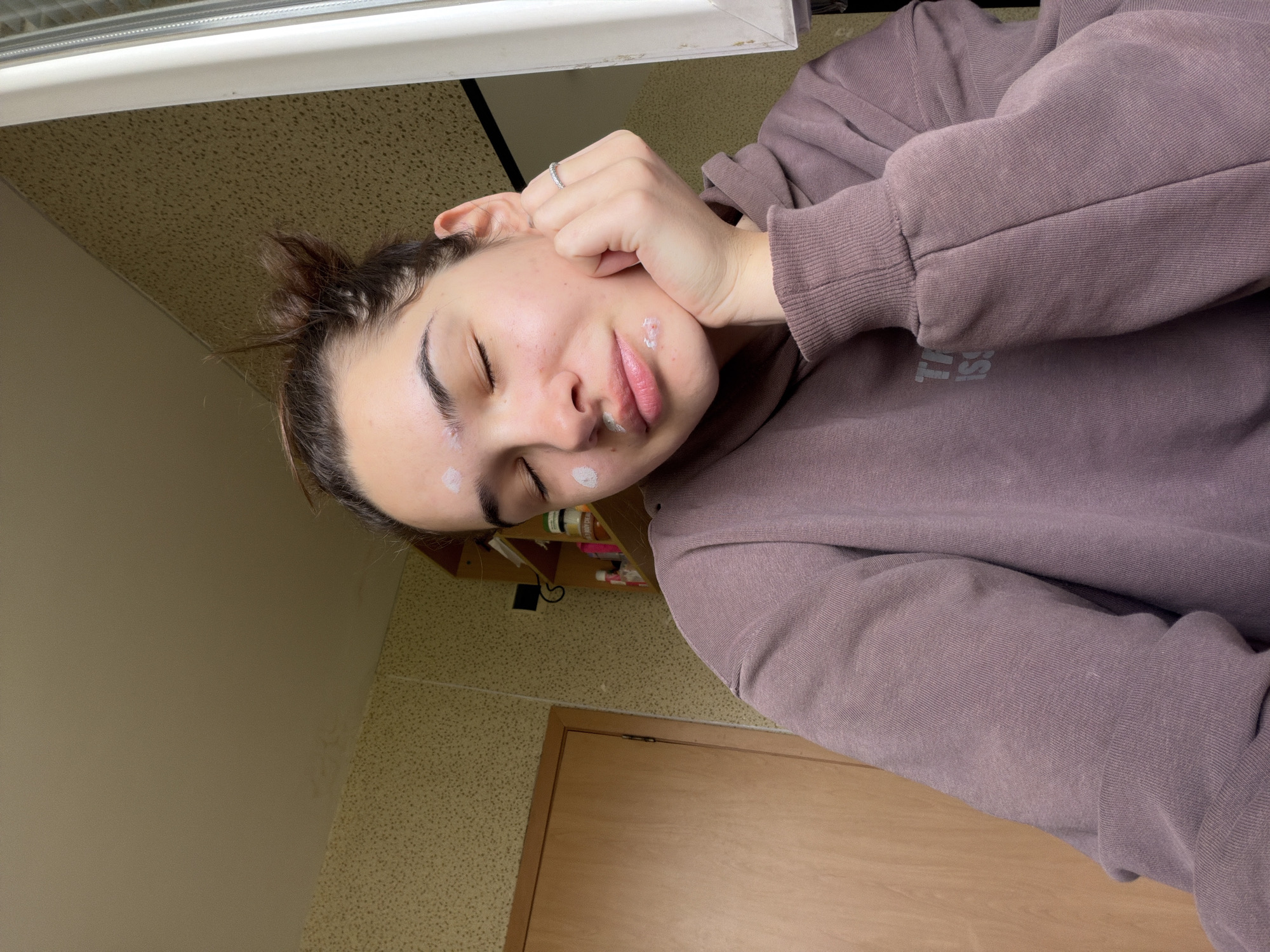 A young woman with dark hair pulled back, fair skin with what appears to be spot treatment cream on her face (forehead, cheek, above lip) is resting her head on her hand. She is wearing a purple long-sleeved sweatshirt. She is indoors, potentially in a room with yellowed walls and a textured ceiling. Behind her, there is a wooden door and a shelf with various items. This scene's location within the city of Sofia, Bulgaria cannot be determined from the image.