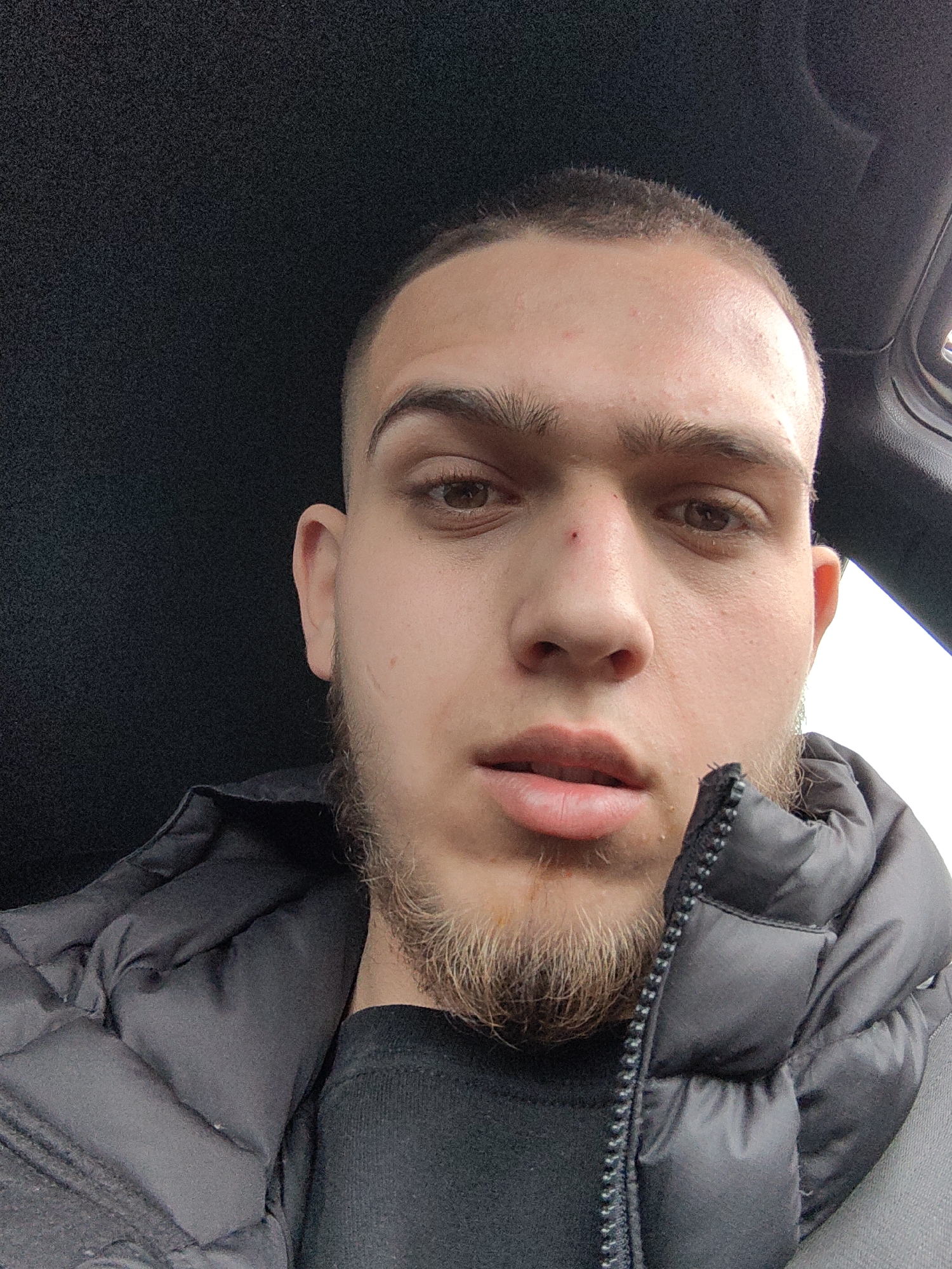 A close-up selfie shows a young man with short, dark hair and a beard. He has brown eyes, light skin with a slight redness on his forehead and a small blemish on his nose. He is wearing a black puffer jacket over a black t-shirt. The background is dark, possibly the interior of a car. The location is not possible to identify as Sofia, Bulgaria.