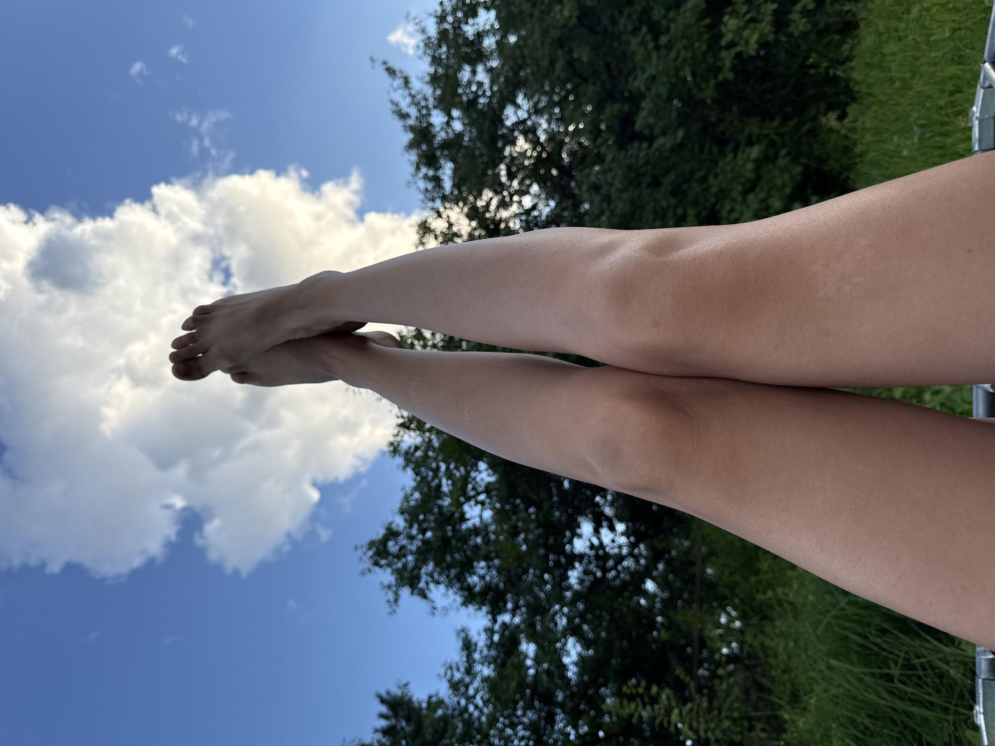 This is a low-angle, outdoor shot of a person's legs and feet extended upwards against a sky with clouds and a backdrop of trees. The person's legs are tanned and show some subtle skin imperfections. The feet are bare, with visible toes. The sky is blue with a large, fluffy white cloud dominating the upper center of the frame. The trees in the background are lush and green, suggesting a natural setting. The image does not provide any specific location details that would indicate it is in the city of Vetluzhskiy, Russia. The scene appears to be a moment of relaxation or playful posing.