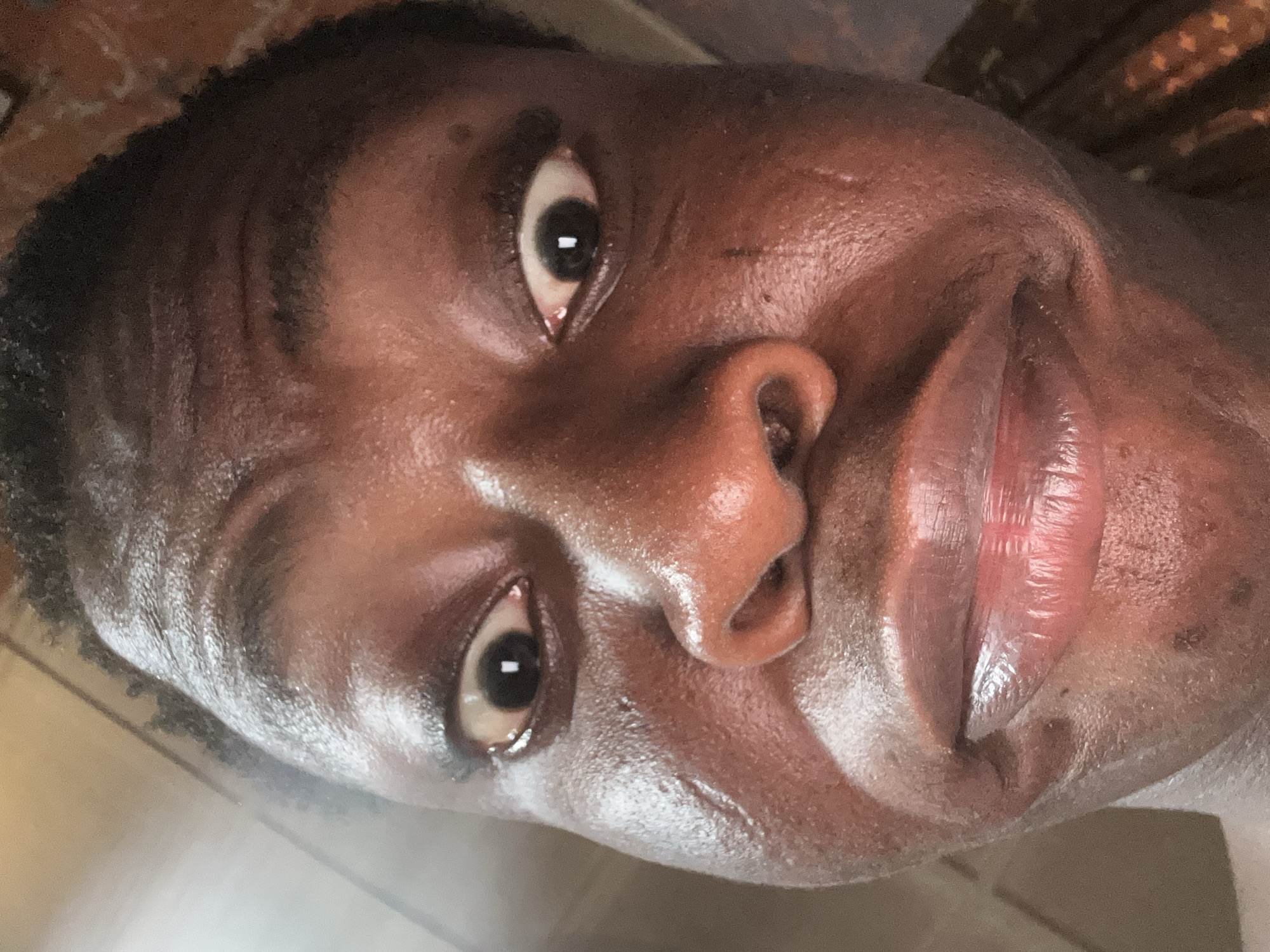 Close-up of a Black male face, slightly tilted. The skin is dark brown and appears glossy. The subject has short, dark hair. The eyes are open and dark brown. The nose is slightly upturned. The lips are full and appear wet. Background details are unclear. The city and location are unknown.