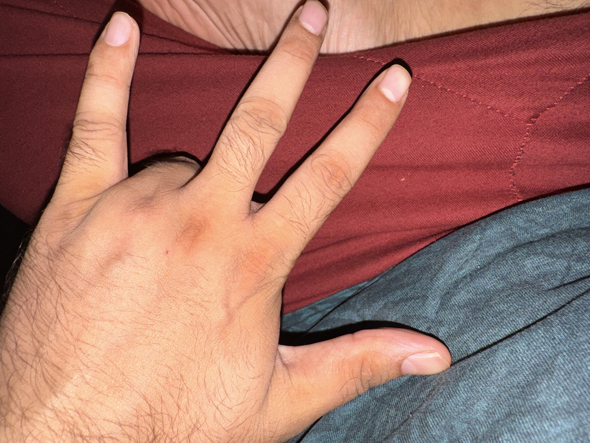 A close-up image shows a hand positioned on clothing. The hand is light-skinned, with visible hair. It is making a gesture, with three fingers extended and the thumb and pinky finger folded inward. The clothing under the hand consists of a dark red garment and a bluish-gray garment. The location and city are unknown.
