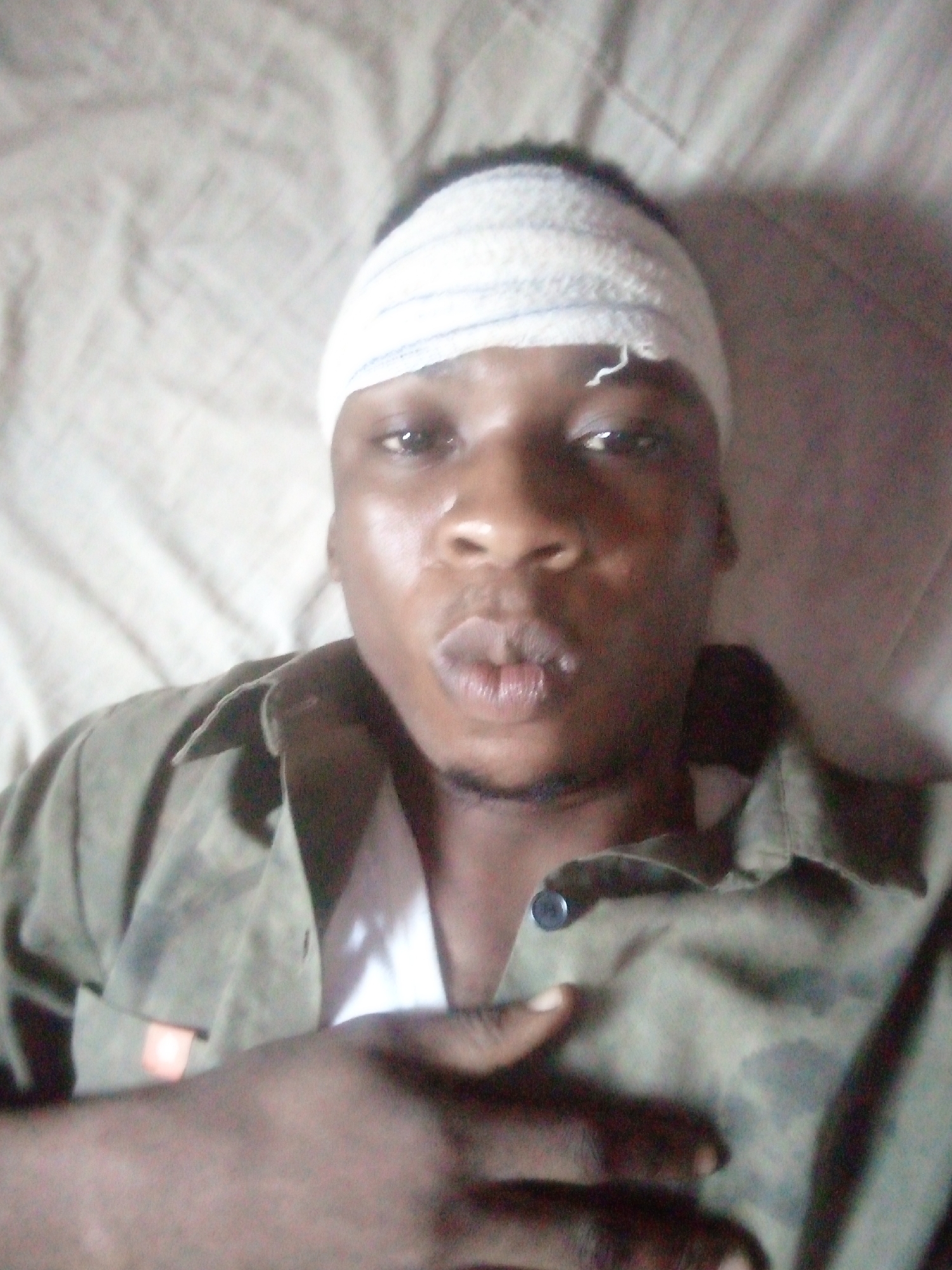 A dark-skinned man lies on his back on a beige bed. He has a white bandage wrapped around his head. He is wearing a dark green shirt over a white undershirt, and his hand is across his chest. The background is out of focus. The location is Unknown, Unknown.