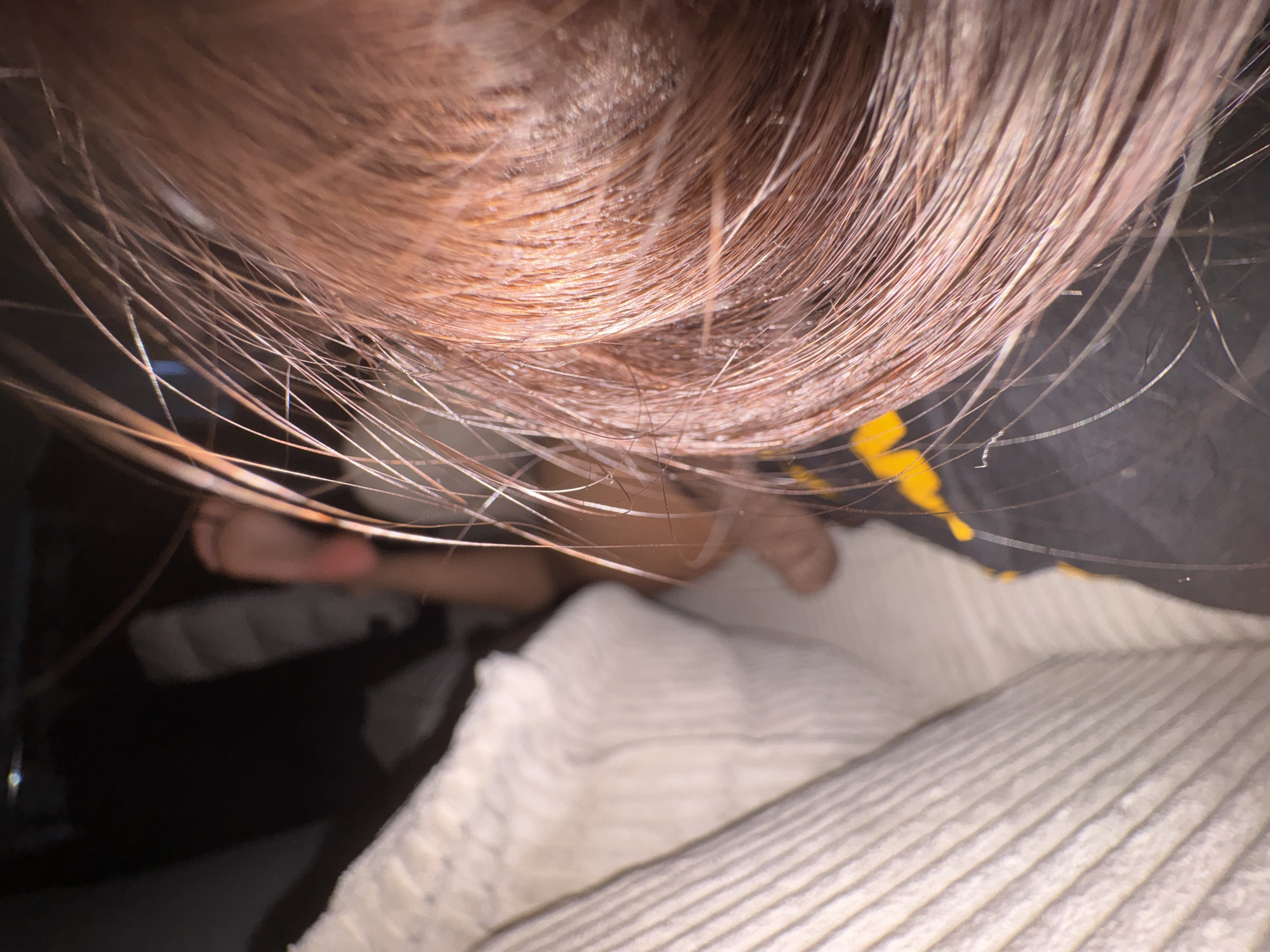 The image shows a close-up view of reddish-brown hair, seemingly from a person lying down. In the background, a white, textured surface is visible, possibly a blanket or bedding, with dark material underneath. A glimpse of a person's foot is also visible, suggesting someone is resting or sleeping. The lighting is dim, creating shadows and highlighting the individual strands of hair. There is no discernible information in the image that can be used to determine a specific location in Mönchengladbach, Germany.