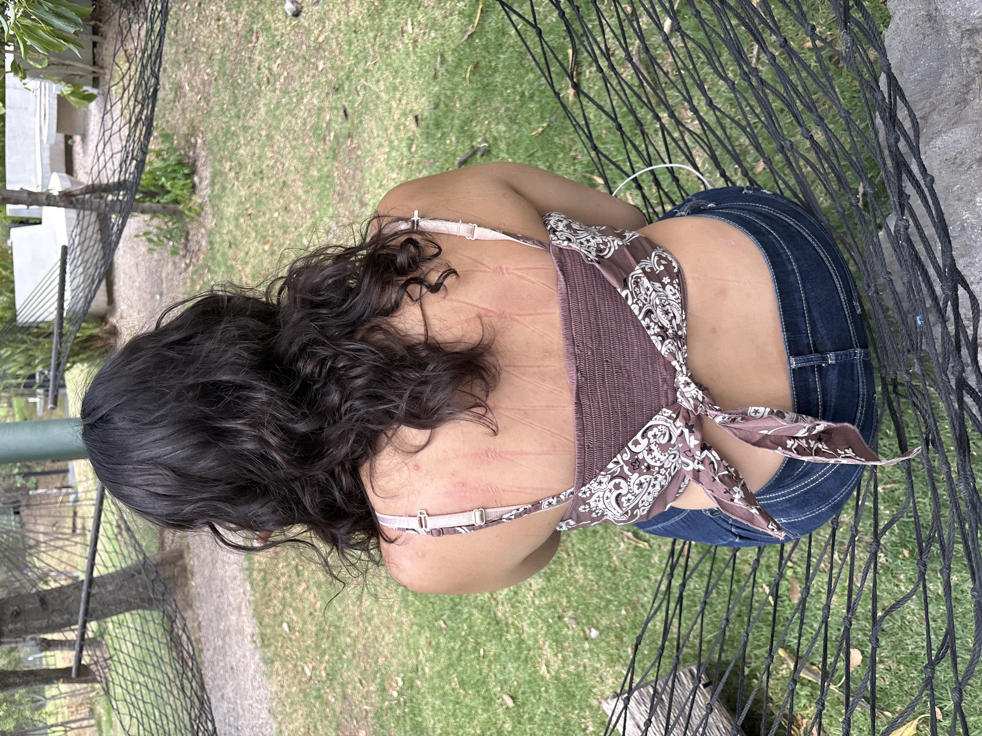 The image shows a person with dark hair and jeans sitting in a hammock outdoors. The location appears to be a grassy area with trees and a pathway visible in the background. The subject has marks or scars on their back and shoulders. The hammock is made of black rope netting. The location is in Jesús del Monte, Mexico.