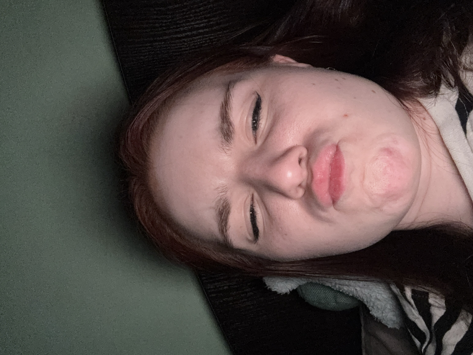 A close-up, slightly rotated image shows a person with fair skin and reddish-brown hair lying on what appears to be a green surface (possibly fabric or a cushioned area). The person has their eyes partially closed and is making a pouting or grimacing expression with their lips pursed. The person has visible makeup eyeliner on the eyelids. Their skin shows some redness or irritation, particularly around the mouth and chin area. There's also a portion of what appears to be a black textured surface and a striped garment in the image. There is no indication that this is a scene from St. Petersburg, Russia.