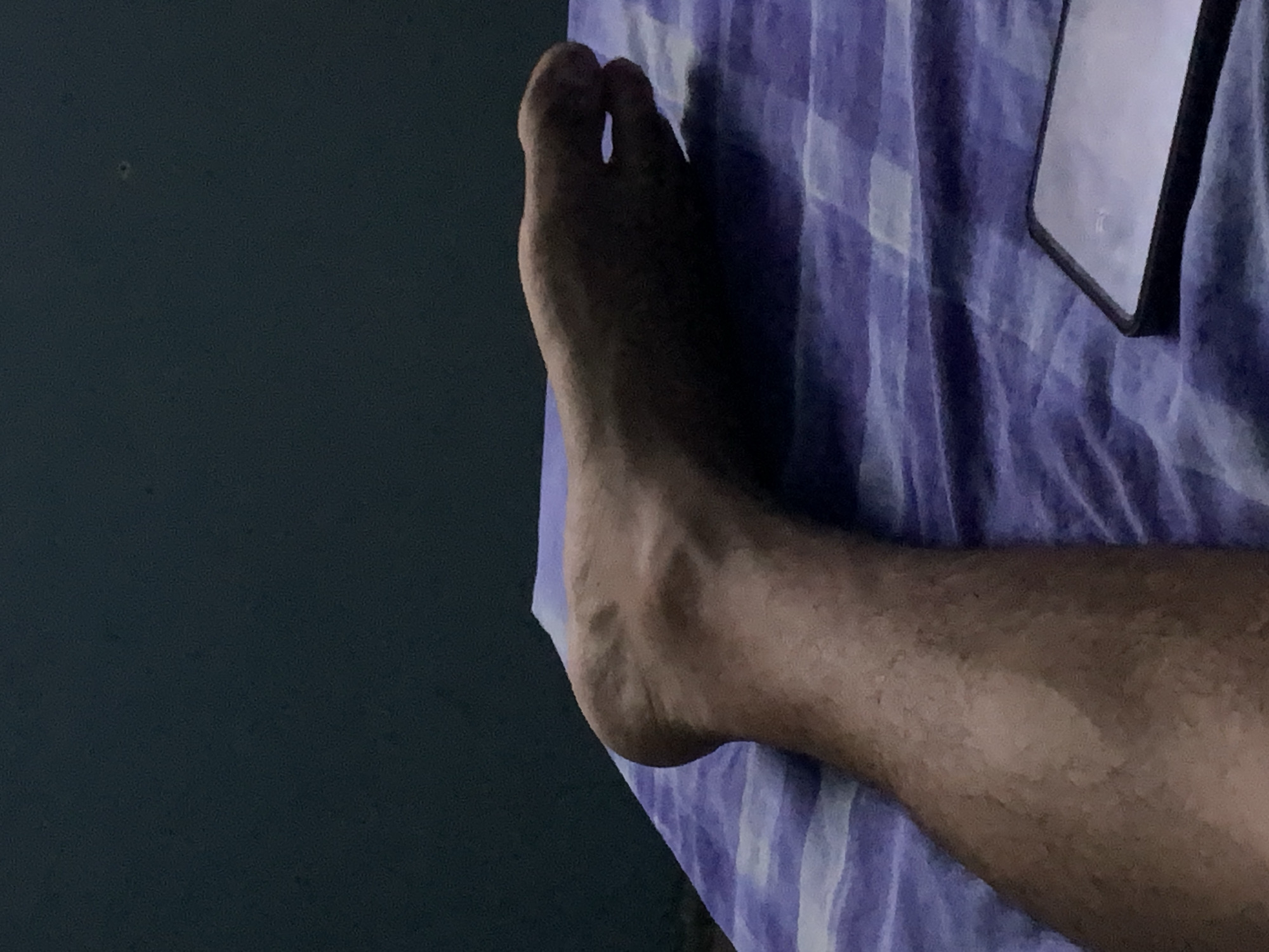 An angled, close-up photograph captures a person's bare right foot and lower leg resting on a patterned surface. The foot, with all five toes visible, extends towards the upper left of the frame. The skin tone is medium to dark, and subtle veins are visible on the top of the foot and ankle. The lower leg, extending towards the bottom right, appears hairy.
The foot and leg are positioned on a purple and white checkered blanket or sheet, which features a distinct plaid or tartan-like pattern. The fabric shows gentle folds and wrinkles. In the upper right corner of the image, a smartphone or tablet is partially visible, resting on the blanket. Its screen is a light grey or white, suggesting it might be on or reflecting light, with a dark bezel around it. No specific text or imagery is discernible on the screen.
The left side of the image features a dark, plain, unidentifiable surface, possibly a wall or another piece of furniture, providing a stark contrast to the patterned blanket. The overall lighting is dim, suggesting it might be evening or a dimly lit room, creating a calm and relaxed atmosphere. The scene depicts a moment of rest. The location context for this image is Santa Ana, Venezuela. No specific activity beyond resting is apparent, and no emotions are discernible. There is no visible text in the image.
