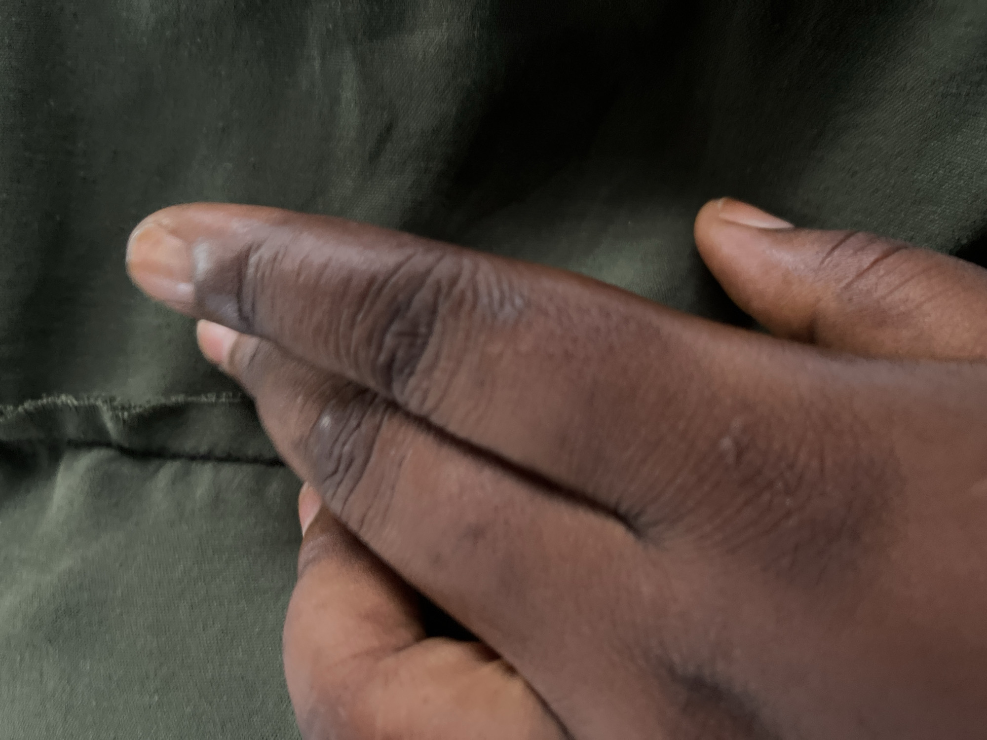A close-up, slightly angled shot shows a person's dark-skinned hand, fingers partially curled, resting on a textured, dark green fabric that appears to be clothing. The fabric exhibits subtle folds and a visible seam running vertically down the center. The lighting casts soft shadows, highlighting the texture of both the skin and the fabric. The image is devoid of any specific landmarks or context to pinpoint its location within Jalingo, Nigeria.
