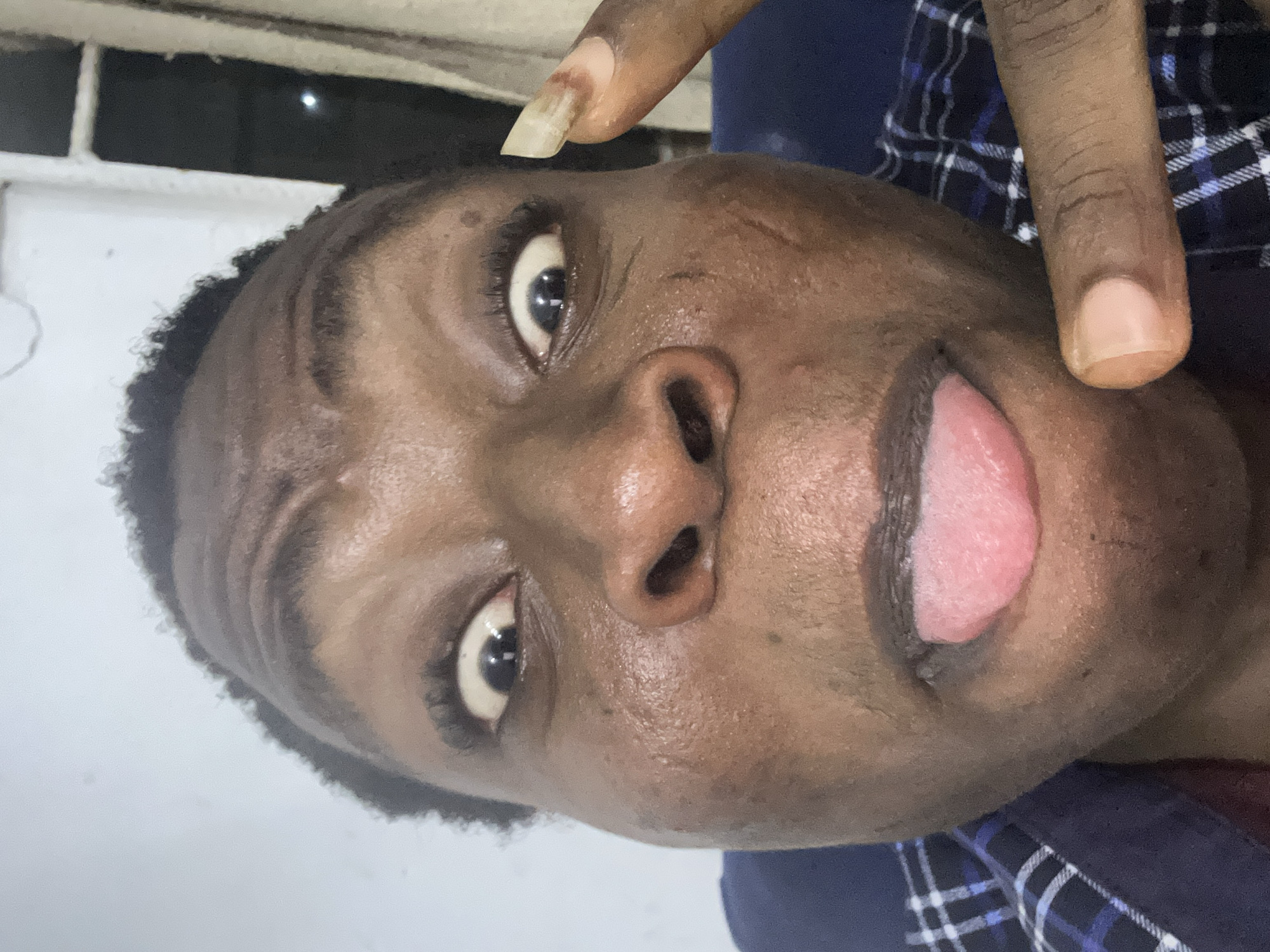 A close-up, slightly angled shot depicts a person of dark complexion. Their tongue is extended. A finger with a long, unkempt nail is positioned above their forehead. The person is wearing a plaid shirt. The location appears to be indoors, with a partially visible window in the upper left. The location is in the city of Unknown, Unknown.