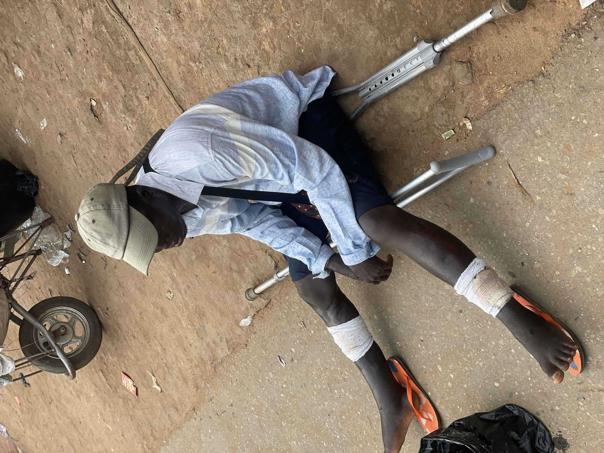 A man lies prone on a paved surface in Nkpor, Nigeria. He is wearing a light-colored, long-sleeved shirt, dark pants, and orange flip-flops. Both legs are wrapped in white bandages. A gray baseball cap covers his head. A pair of crutches rests near him. A cart with a small wheel and a black plastic bag is partially visible near his head. The paved surface is cracked and uneven. There is litter scattered around the area.