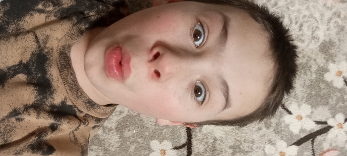 Scene located in Красный Маяк, Russia. A young individual is depicted in a close-up, head-and-shoulders shot, with the image oriented such that the subject's head is tilted left. The person has light skin, visible freckles, and pink cheeks. Dark brown hair is evident. The dark brown eyes are open and directed towards the camera. The lips are pursed. The individual wears a long-sleeved garment with a brown and black mottled pattern. The background is a light gray rug or carpet featuring a repeating pattern of white flowers with orange centers and dark connecting stems.