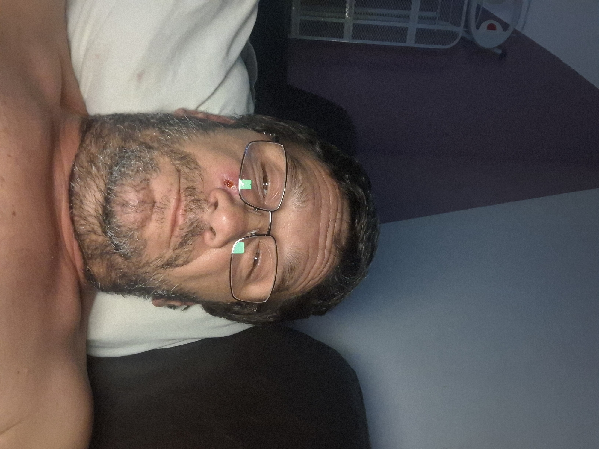 A man with graying stubble and hair, wearing glasses, is lying on his side on a pillow. He has a small abrasion on his cheekbone with a small green object protruding from it, possibly medical tape. The background shows a dark wall and a rack with some items on it. The image appears to be taken indoors. The location is stated to be Yerocham, Israel.