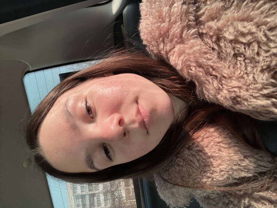 The image presents a young female inside a vehicle, likely a car, in Chaikovsky, Russia. She is centrally positioned, looking directly at the viewer with a neutral expression. Her features include fair skin with areas of natural redness on the cheeks and forehead, dark brown hair, and brown eyes that appear slightly narrowed, possibly due to sunlight. She is wearing a light-colored garment beneath a shaggy, light brown or beige faux fur coat, the texture of which is highly visible on her right side. Strong sunlight enters from the left, illuminating her face and coat, creating distinct highlights.
Through the vehicle's rear window, a clear light blue sky is visible above a cityscape. The background displays several multi-story residential buildings, characterized by a utilitarian architectural style with numerous rectangular windows, consistent with typical urban structures in Russian cities. Sparse, bare trees are visible in the mid-ground, suggesting a cooler season. The upper right corner shows portions of the vehicle's interior, including the window frame and a dark headrest.