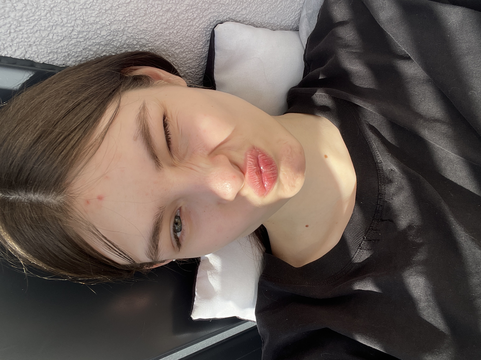 A young woman is lying on her side on what appears to be a bed or soft surface. She is propped up with a white pillow behind her head. She is wearing a black, long-sleeved shirt. The woman has brown hair and is winking with her left eye, while pursing her lips. There is sunlight shining across her face, creating shadows. There are a few blemishes on her forehead and cheek. The background includes a textured white wall and what looks like a black surface, possibly a bed frame. The location cannot be determined from the visual data.