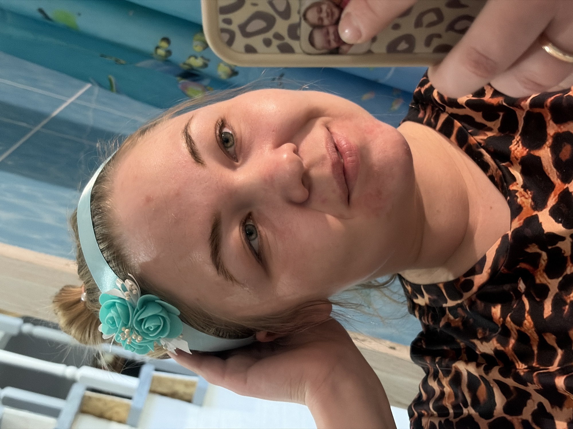 This image, taken in Noviy, Russia, features a young woman photographed from an elevated and rotated perspective, likely a selfie taken while she is lying down. She has fair skin, green eyes, and light-colored hair, which is held back by a light blue headband. The headband is decorated on the left side with a cluster of teal and white floral embellishments and small beads.
The woman is wearing a leopard-print top or dress and looks towards the camera with a soft, slightly smiling expression. Her facial skin shows some minor blemishes on the forehead, cheek, and chin. Her eyebrows are well-defined.
In the upper right portion of the frame, a hand with a gold ring on one finger holds a mobile phone. The phone has a cream-colored case with a leopard print design, and its reflective surface shows the blurred images of two faces.
The background behind the woman consists of a blue surface with subtle, lighter patterns, possibly indicating a bedspread, curtain, or wall covering. In the lower left, part of a white or light-colored piece of furniture, such as a bed frame, is visible. The scene is indoors. No visible text is present in the image.