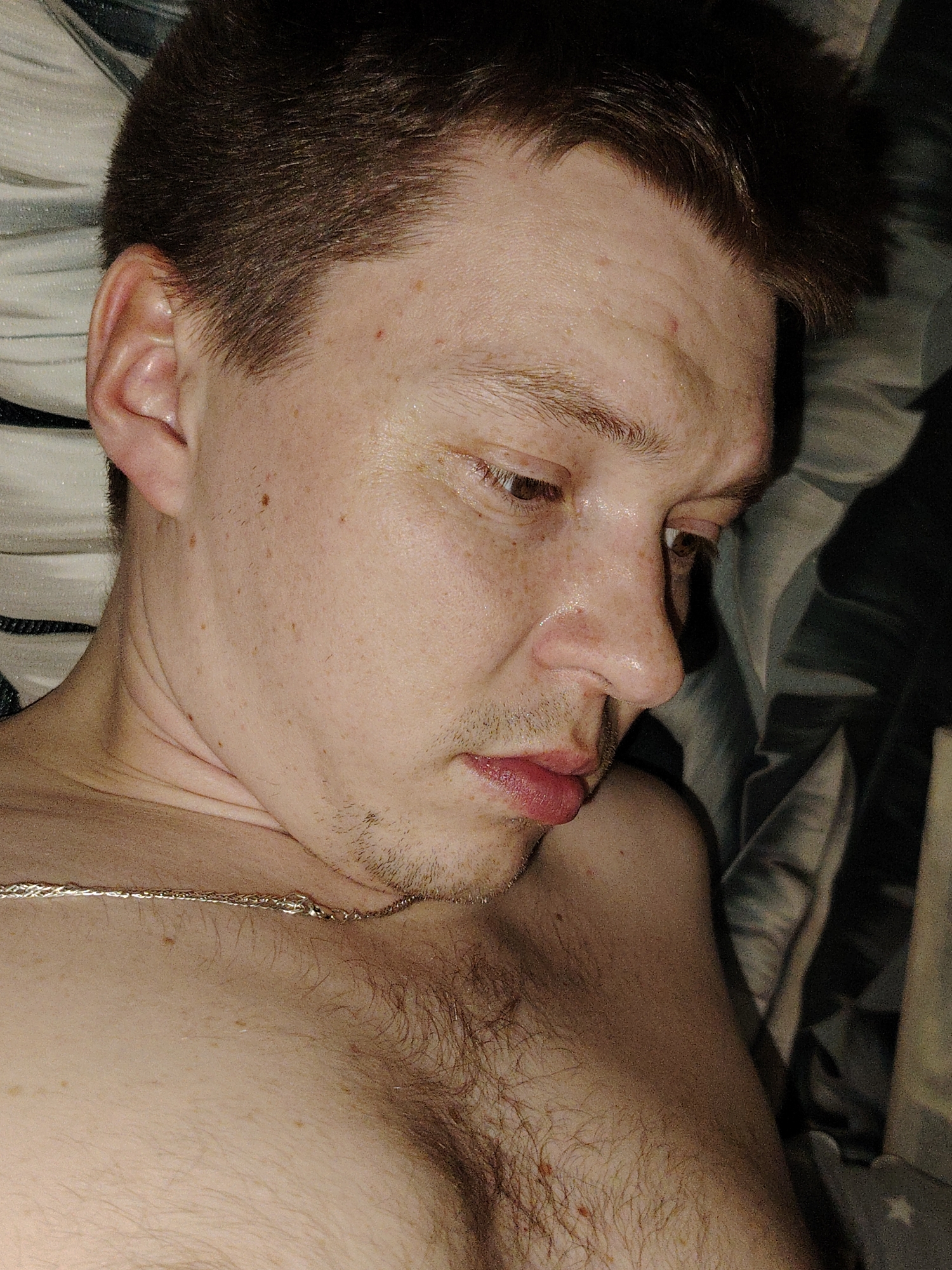 The image displays a close-up, high-angle view of an adult male in the city of Марковский, Russia, reclined against a striped textile background. The subject possesses short, dark brown hair and fair skin, marked with numerous freckles and small moles across his face, neck, and upper chest. His head is turned to his right, with his brown eyes looking downwards. Visible stubble covers his chin and upper lip. The skin on his forehead, nose, and lips appears slightly moist. He is shirtless, revealing light brown chest hair and a thin, silver-colored chain worn around his neck. The background consists of bedding or soft textiles with alternating light grey, white, and dark grey stripes or patterns, under dim lighting conditions. No explicit actions or interactions beyond his reposed posture are discernible.
