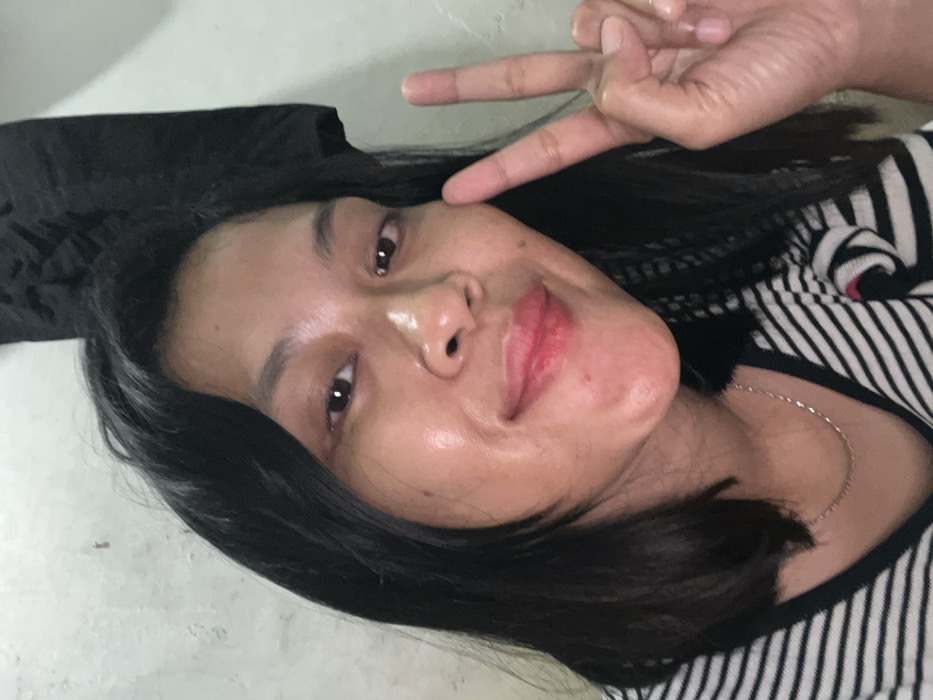 A person poses for a selfie, tilted sideways. They have dark hair, brown eyes, and fair skin with a shiny appearance. Their lips are slightly parted with a reddish hue. The person is wearing a black and white striped shirt and a thin silver necklace is visible. One hand is raised, forming a peace sign. A dark fabric appears on the left. The background is light-colored and slightly blurred.