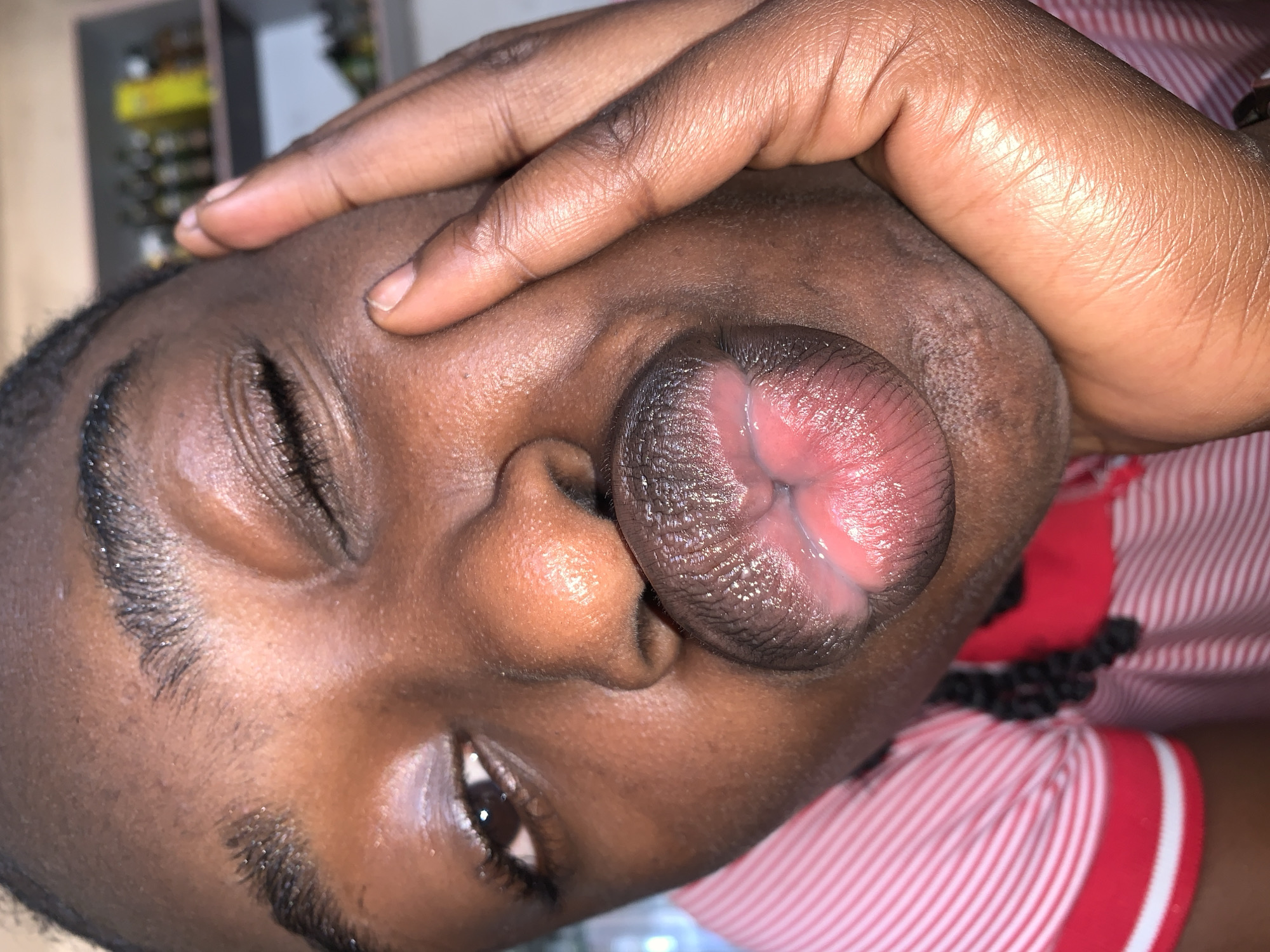 The image displays a close-up, rotated view of a person with dark skin tone, likely indoors. The most prominent feature is the person's lips, which are extremely swollen and everted, revealing the moist, pinkish-red inner tissue. A distinct cross-like or star-like fold is visible at the center of the everted lips.
A hand, also with a dark skin tone, rests on the person's forehead and temple area, with fingers partially visible. The person's eyes are mostly closed or partially open; one eye appears dark brown and slightly visible, looking towards the right. Dark eyebrows and facial hair are present.
The person is wearing a red and white striped garment, possibly a shirt, visible around the neck and shoulder area. The background is out of focus, showing blurred shapes that suggest shelves or furniture holding various items, indicating an indoor setting. There is no visible text in the image.
The scene depicts a person potentially experiencing a medical condition causing significant lip swelling, such as angioedema or an allergic reaction, given the dramatic eversion and size of the lips. The hand placement could suggest discomfort or an attempt at soothing. This media file is provided with the location context of "New Stadium, Nigeria."