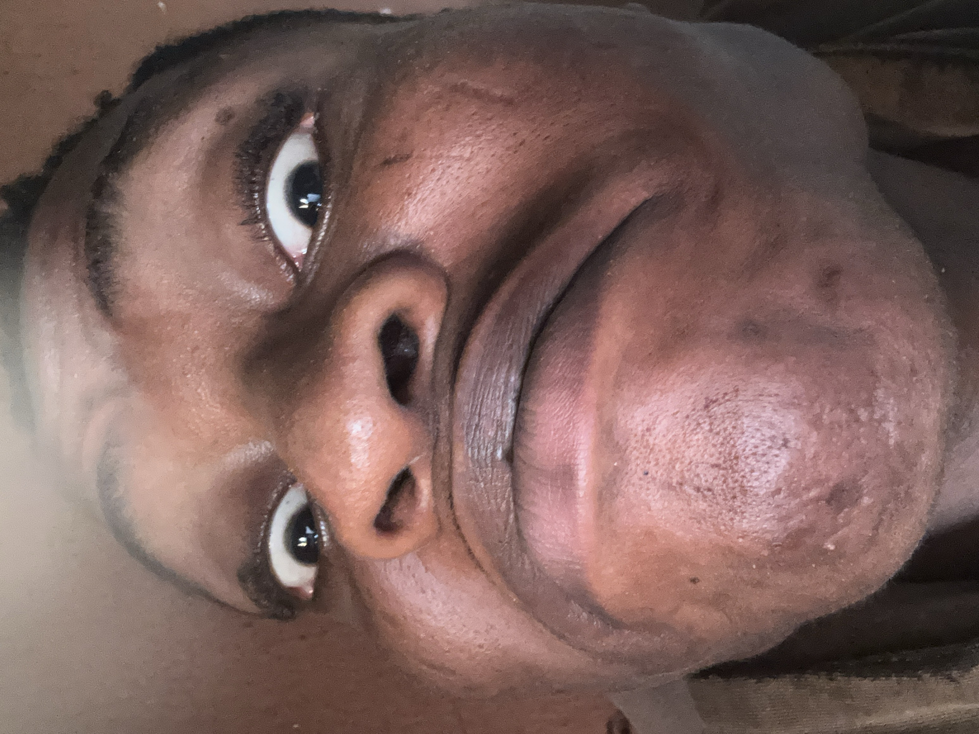 A close-up photograph shows the face of a person with dark skin. The camera angle is slightly below the subject, looking up at their face. The person's eyes are wide open, and their nose is prominent in the frame. The lighting is somewhat uneven, with some areas of the face appearing more illuminated than others. The image appears to have been taken indoors. There is no information available about the city or the specific location where the photo was taken.
