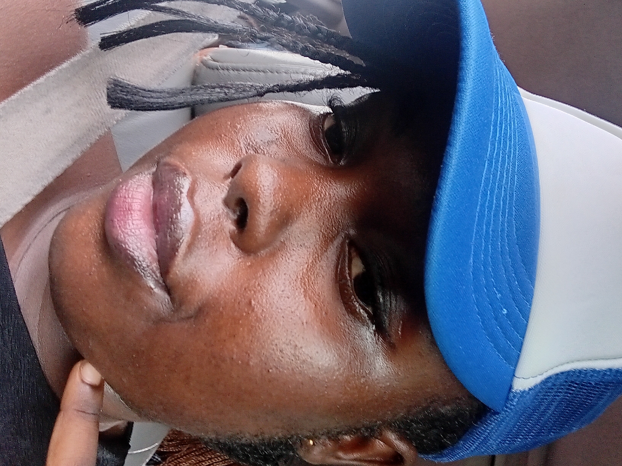A close-up, medium shot depicts a young Black woman from the chest up, wearing a blue and white trucker hat. She is looking towards the camera. Her skin appears oily with visible pores and small bumps, particularly on her cheeks. She has dark eye makeup. Her lips are painted a light, shimmery pink. Braids hang down on her left side, and a hint of another braid is visible on her right. A grey seatbelt is visible across her chest. She is wearing a black top. Her right index finger is extended and touching her chin. The background is blurred, showing hints of a car interior with a grey seat and a dark headrest. The overall scene suggests the woman is inside a vehicle, potentially in a city setting like Adoma, Nigeria, given the provided context, though the image itself does not contain definitive geographical markers.