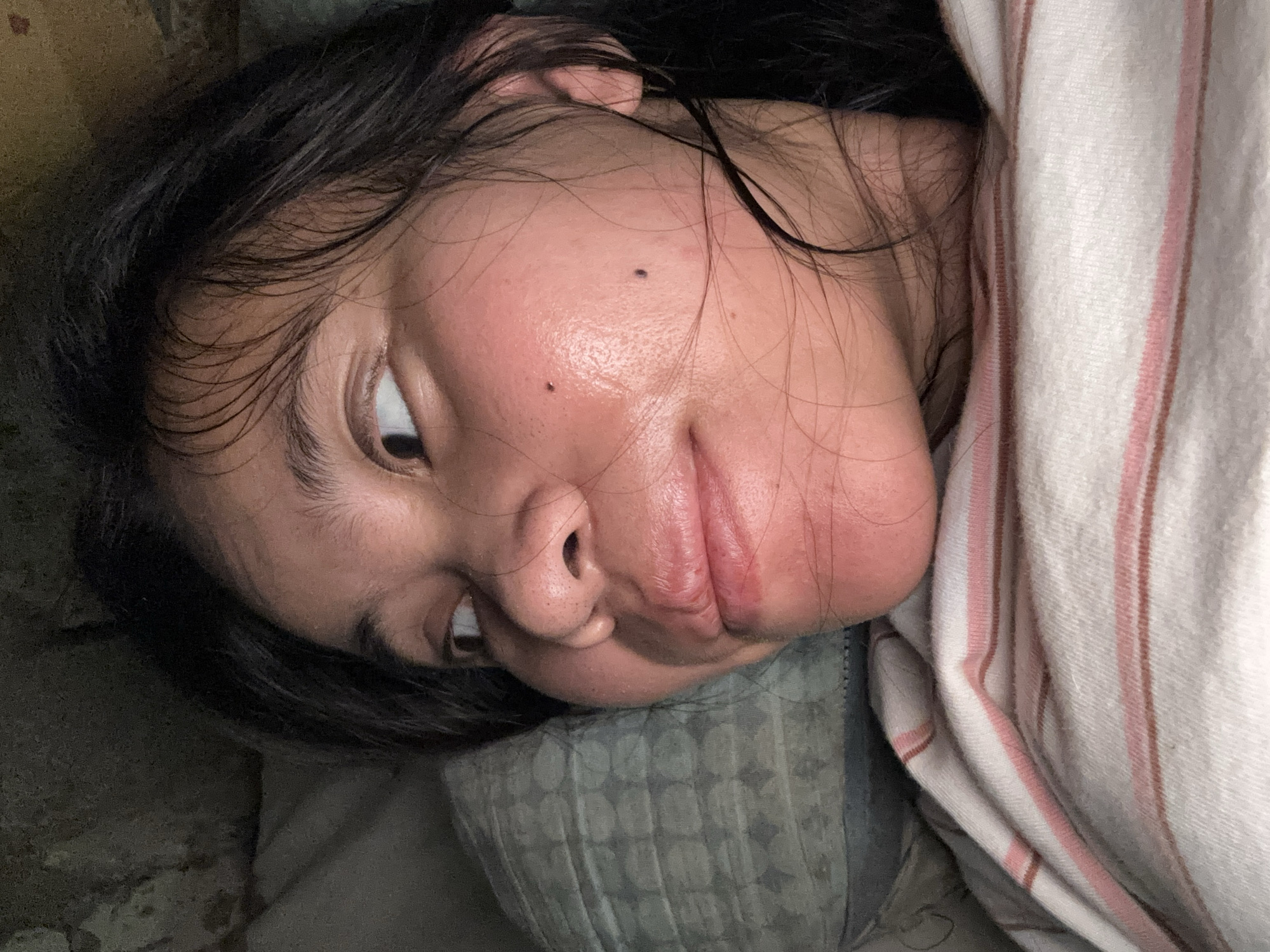 A close-up, profile shot of a young East Asian woman lying on her side, looking to her left. She is on a bed, with a patterned pillow behind her head and a striped blanket covering her chest. Her dark hair is messy and falls around her face. Her skin appears slightly oily and flushed, with a few small blemishes visible. A mole is present on her right cheek. The lighting is dim, suggesting it is nighttime or a dimly lit room. The background is dark and appears to be a wall or textured surface. No specific location in East Jakarta, Indonesia, can be identified from the image itself.