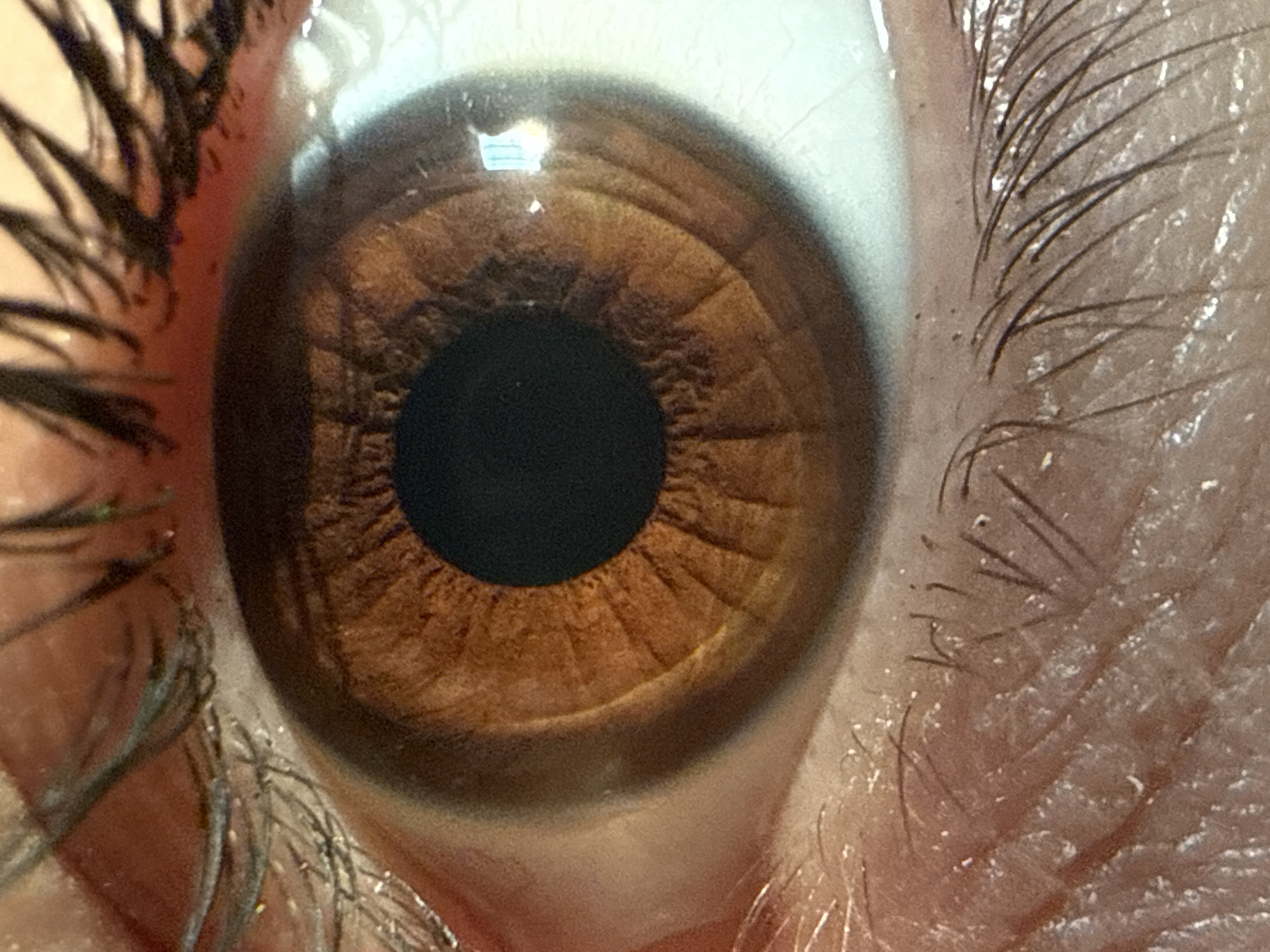 A close-up, macro photograph captures a human eye with a brown iris. The pupil appears black and circular at the center of the iris. The iris displays intricate radial patterns and lighter brown textures, with a darker brown outer ring. The sclera, the white part of the eye, is visible and appears to have a slight yellowish tint. Eyelashes frame the eye, with some appearing slightly clumped, and the skin around the eye exhibits texture and fine hairs. A reflection of a bright, rectangular light source is visible in the upper right quadrant of the eye. The image lacks any contextual information about its location within a city or any specific environmental details.