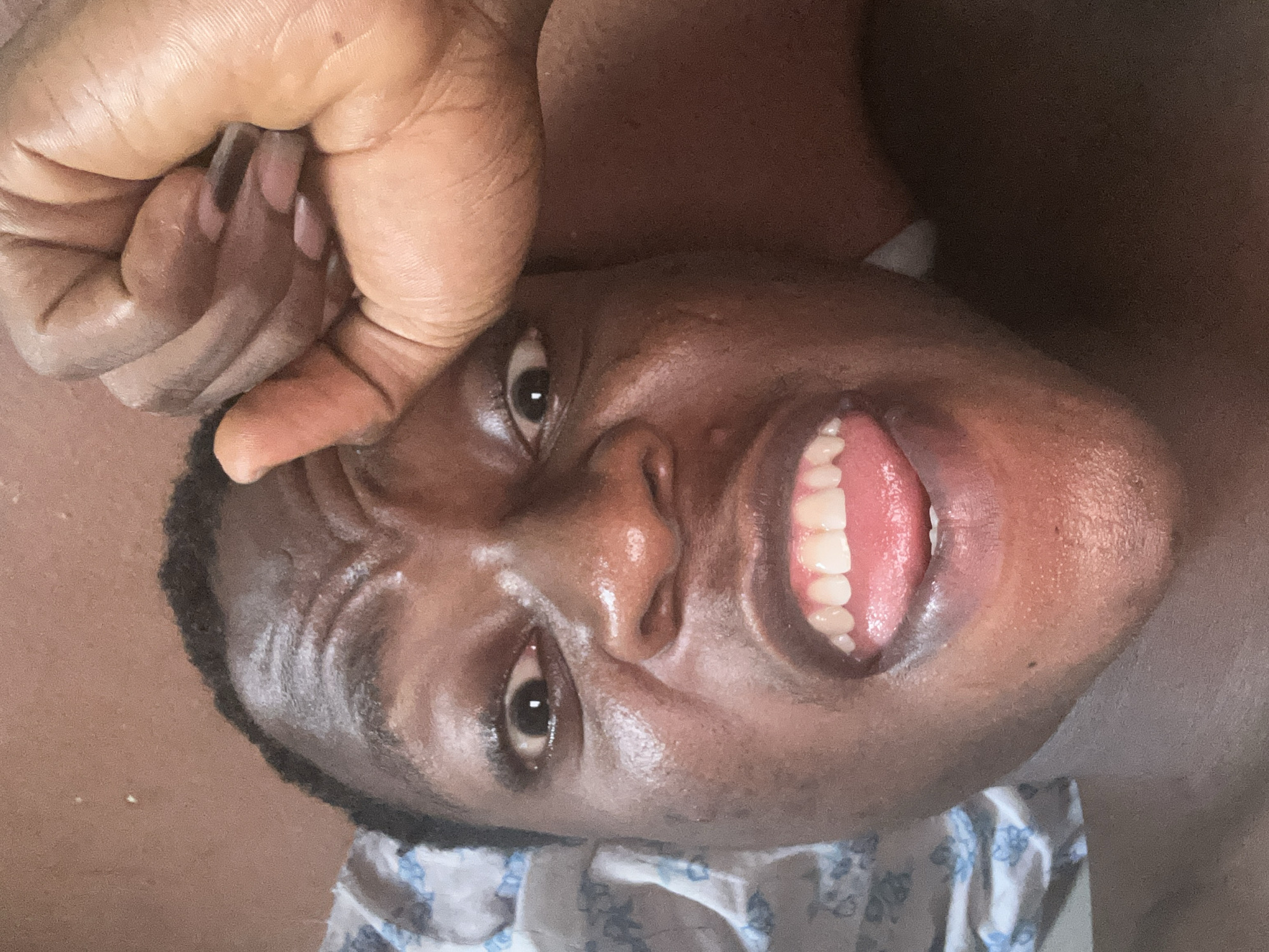 The image shows a close-up, tilted perspective of a person with dark skin, potentially lying down. Their face is prominent, displaying an open mouth revealing teeth and tongue. One hand is raised above their forehead, fingers clenched. The background appears to be a light-colored surface, possibly fabric with a floral pattern, or bedding. The person's skin appears somewhat shiny, suggesting moisture or oil. The location is not identifiable from the image.