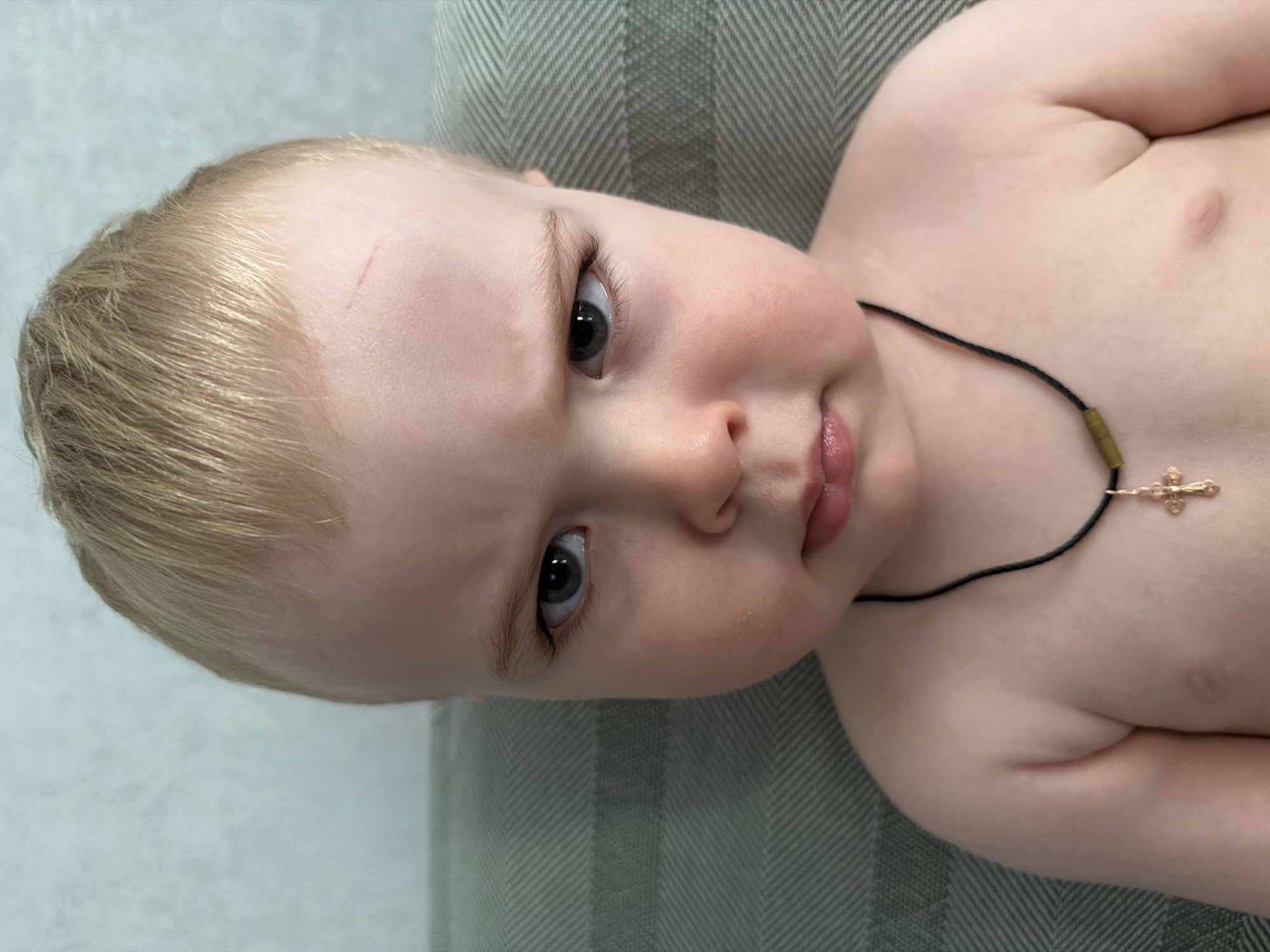 A close-up photograph depicts a baby with blond hair and fair skin. The baby is wearing a necklace with a cross pendant. There is a scratch visible on the baby's forehead. The background appears to be a textured, striped surface. The location is unknown and cannot be determined from the image.