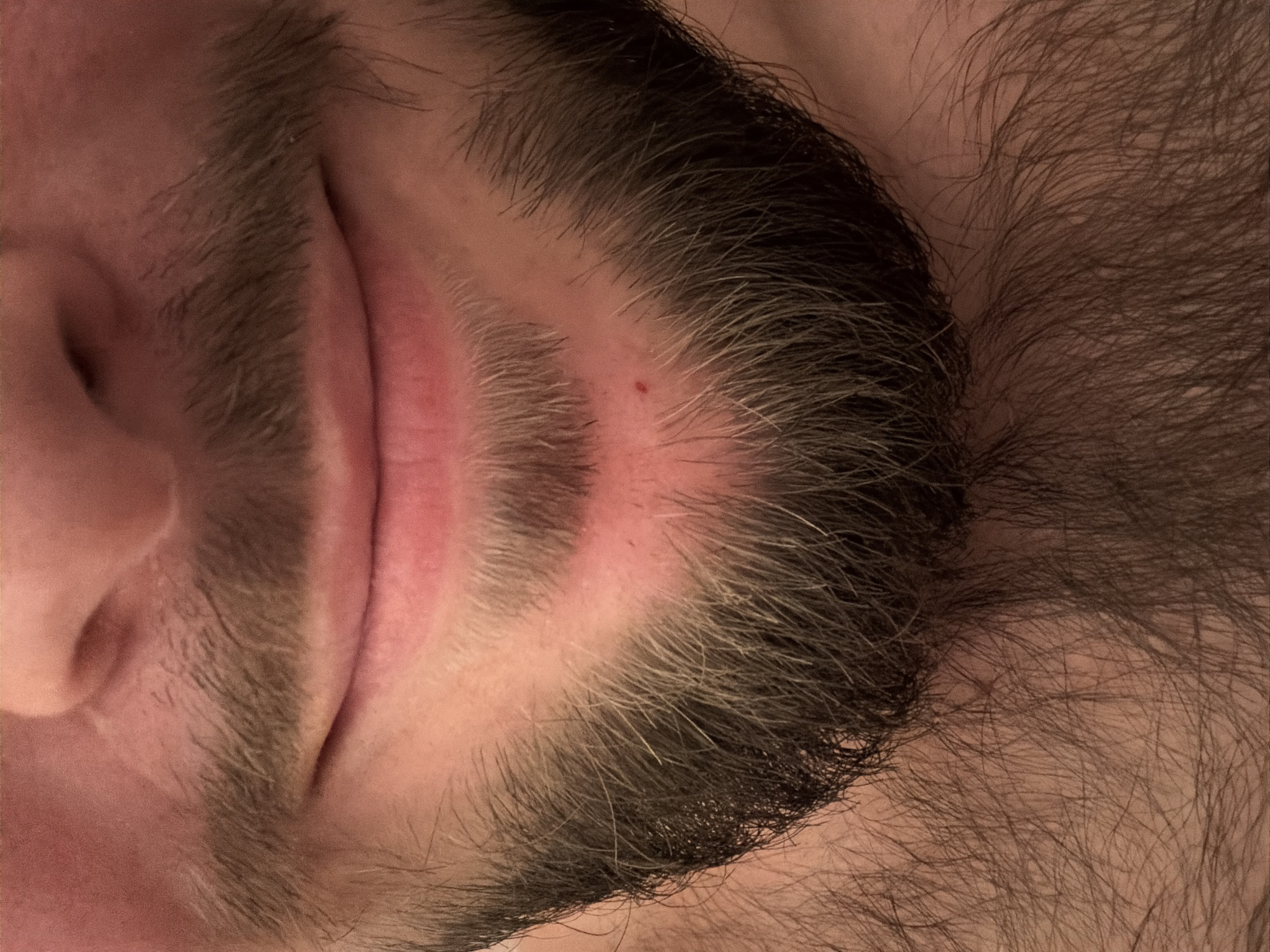 A close-up, indoor photograph shows a portion of a person's face including their nose, lips, and hair. The person appears to be lying down. The hair is dark with grey strands. The lips are pink. There is a small red mark on the person's forehead, which is close to the hairline. The setting or location in Tbilisi, Georgia cannot be determined from this image.