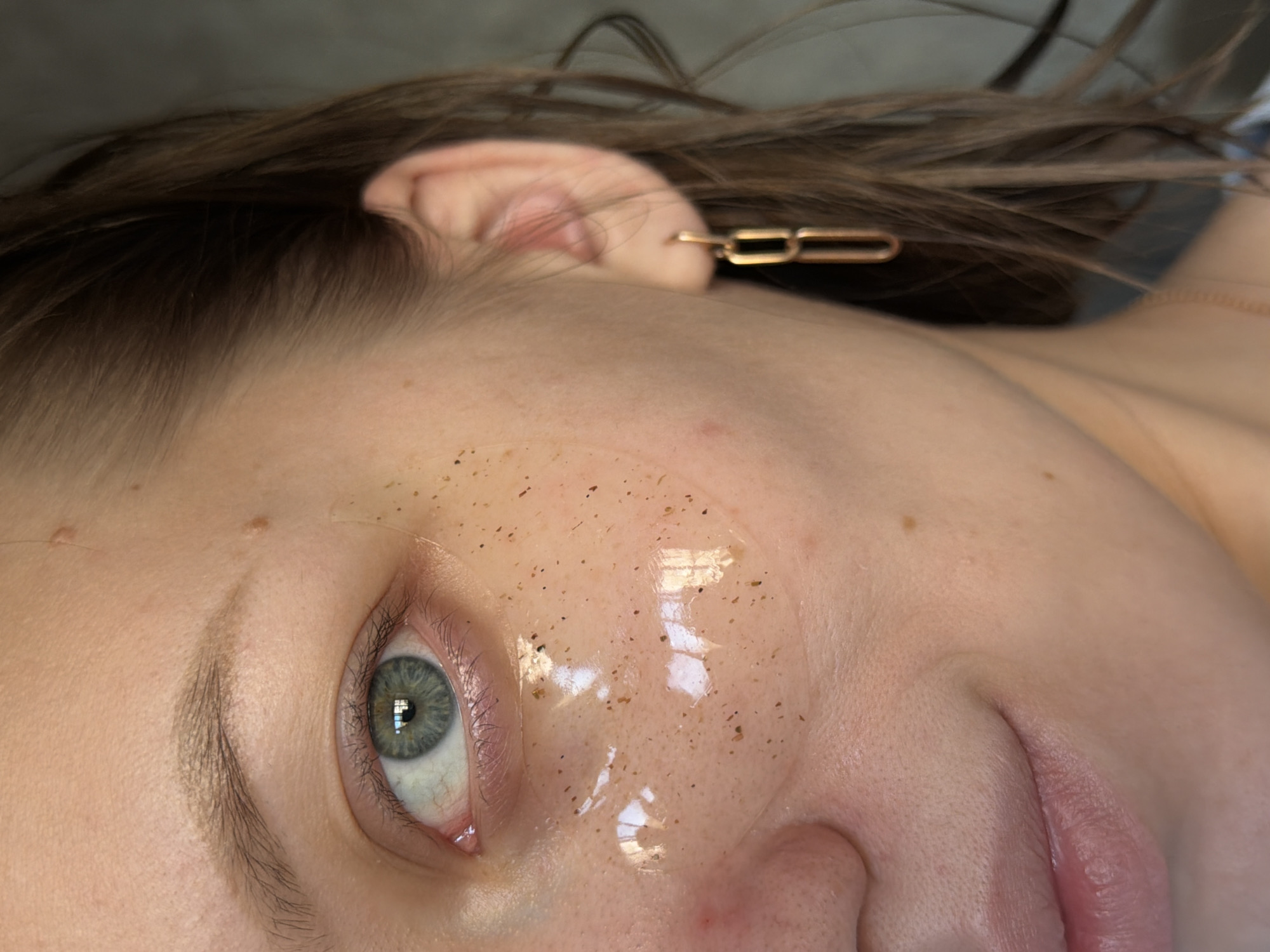 A close-up, tilted view shows a person's face with an eye looking towards the camera. The person has light skin and brown hair. A gold-colored rectangular hair clip is visible near the ear. A clear substance with small, dark particles covers the skin around the eye and cheek. The person's lips are partially visible. The location is not discernible from the image.