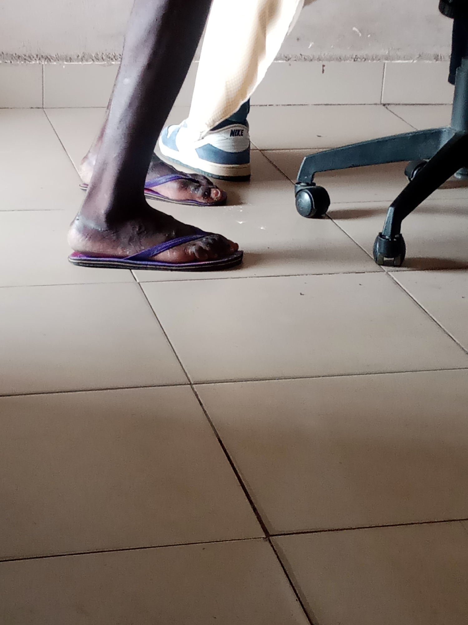 The image shows a close-up view of two people's legs and feet, standing on a tiled floor. One person is wearing purple and black flip-flops, with their feet appearing somewhat discolored and possibly dry. The other person is wearing a white and blue Nike sneaker, with the "NIKE" logo clearly visible on the side. A portion of a black office chair with wheels is also visible in the lower right of the frame. The background shows a wall with horizontal lines, suggesting it might be a plastered surface. The lighting suggests it is daytime. The overall scene appears to be indoors, possibly in an office or home environment, given the tiled floor and office chair. The activity depicted is simply standing. No specific emotions are conveyed due to the focus on the lower extremities. The location context is Jalingo, Nigeria.