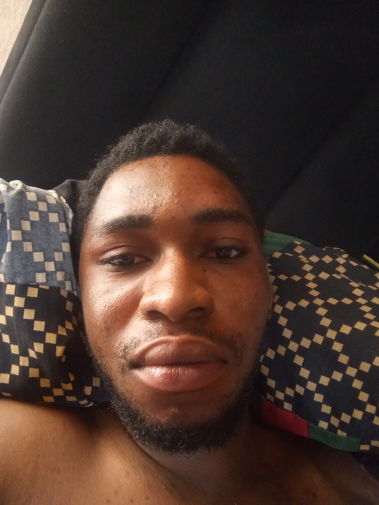 A close-up, head-on, indoor shot shows a young Black male lying on his back, propped up by pillows. The man's head is tilted slightly to the right. He has dark curly hair, dark eyebrows, and a light beard. His eyes are open and looking towards the camera. The man's skin is dark brown, with some blemishes on his forehead and cheeks. He is shirtless. The pillows are patterned with small black and white squares, and one pillow has a green and red trim. The background is a dark, textured surface, possibly a wall or headboard. The lighting is bright, casting subtle shadows on the man's face.