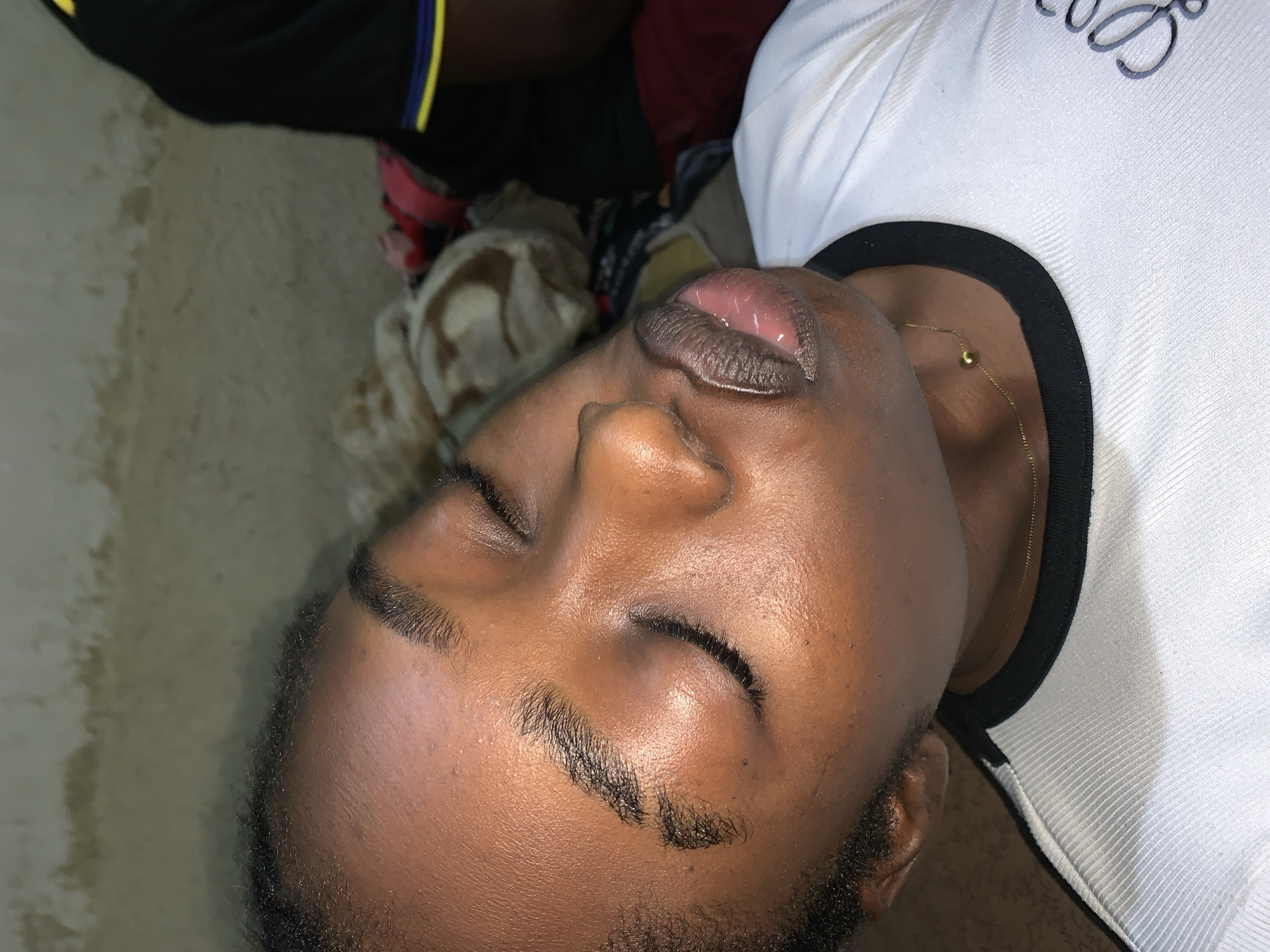 This is a close-up, medium-shot, outdoor, vertical, eye-level, natural light, medium-saturation photograph of a young Black female sleeping. Her eyes are closed, and her head is tilted slightly back. Her lips are parted and appear slightly swollen. She is wearing a white t-shirt with a black trim and a thin gold chain with a single bead around her neck. A portion of another person wearing a black shirt with yellow trim is visible on the right side of the frame. The background consists of a textured, light-colored wall and some folded blankets or fabric. The overall impression is one of rest or possibly discomfort due to the swollen lips. The location is stated to be in Rafin Par, Nigeria.