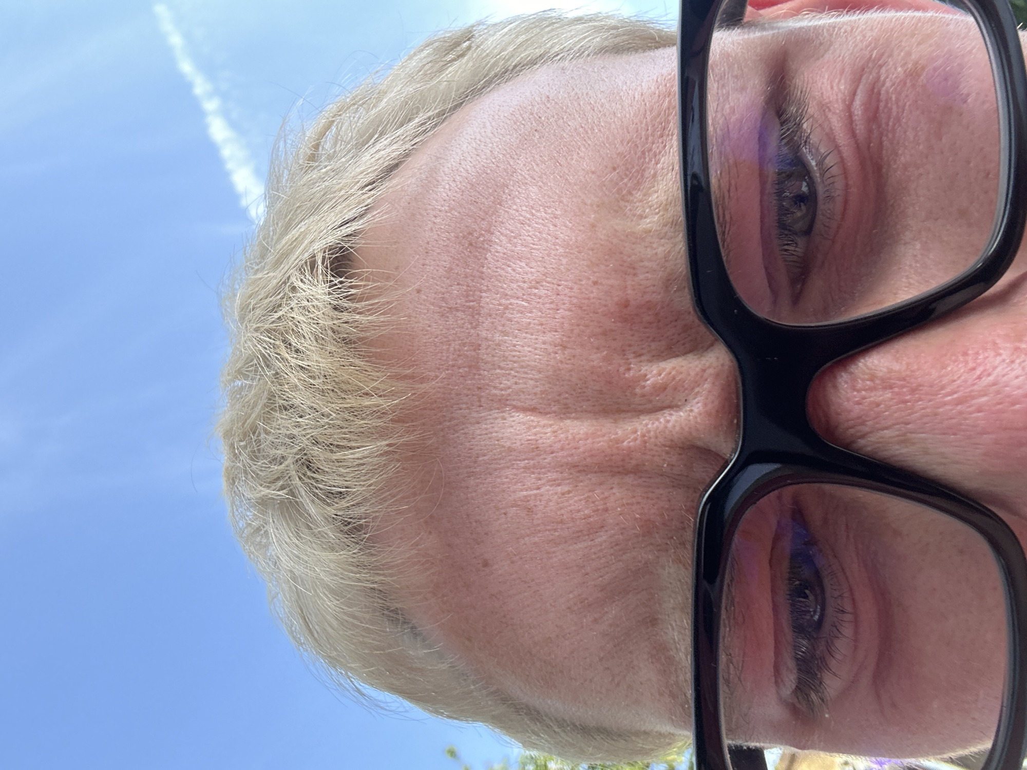 A close-up, tilted selfie shows a person with white-blonde hair and black-framed glasses. Wrinkles are visible on the forehead and around the eyes. The sky is visible in the background, and contrails are present in the upper left corner. No specific location in London can be determined from the image.