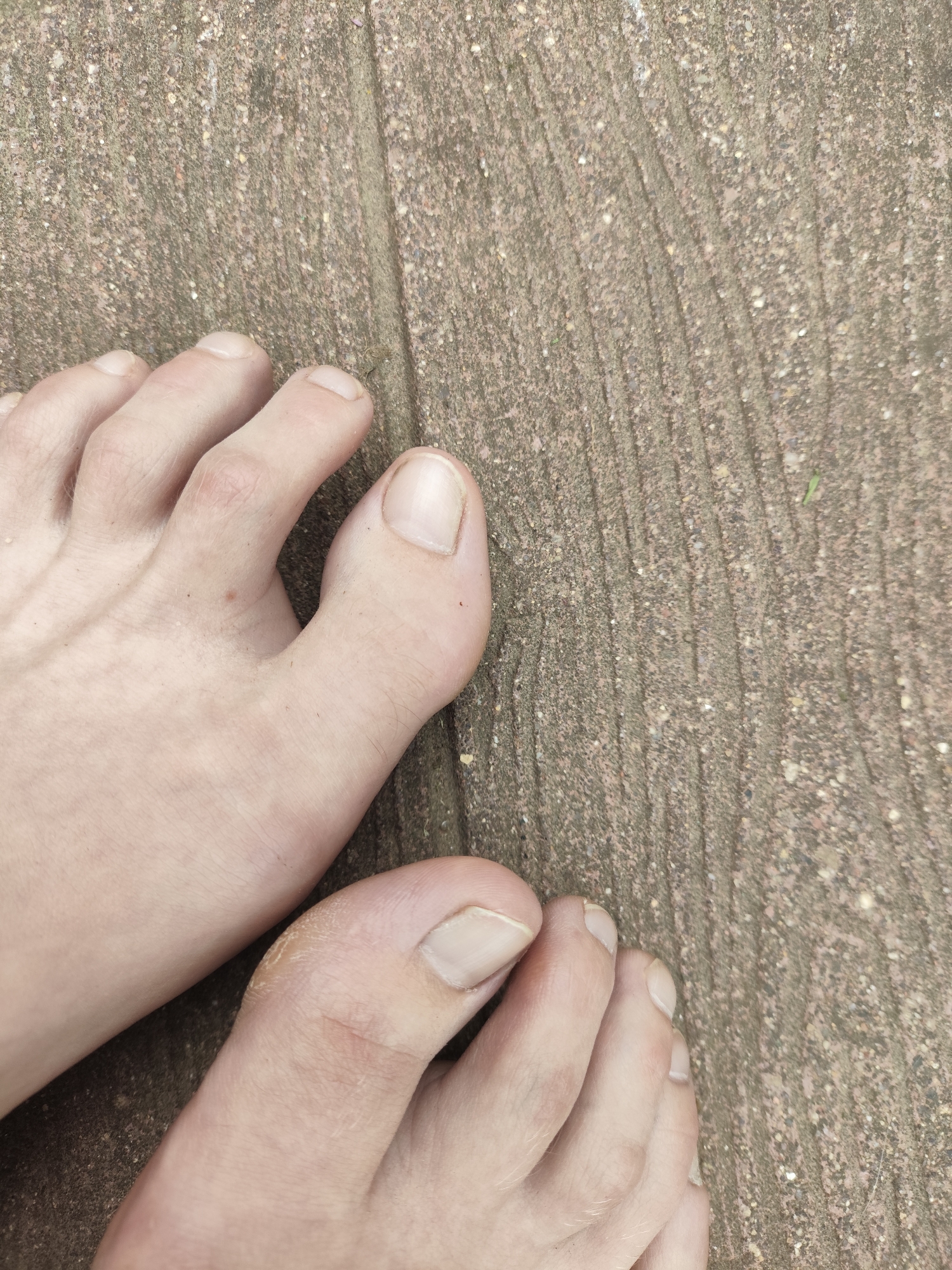 A close-up, overhead shot shows two feet resting on a rough, textured concrete surface. The feet are positioned near the bottom of the frame, with the toes of both feet visible. The concrete appears to be weathered, with visible lines and embedded stones. One foot is slightly more prominent, with its toes pointing towards the upper left of the image. The other foot is partially visible to the bottom right. The skin tone of the feet is fair, and some light stubble is visible on the toes. The nails are natural and appear to be unpolished. The lighting is even, suggesting an outdoor setting, possibly during daylight hours. There are no other visible objects or people in the frame. The scene is devoid of any elements that would specifically place it in Прогресс Снт, Russia, beyond the provided location context.