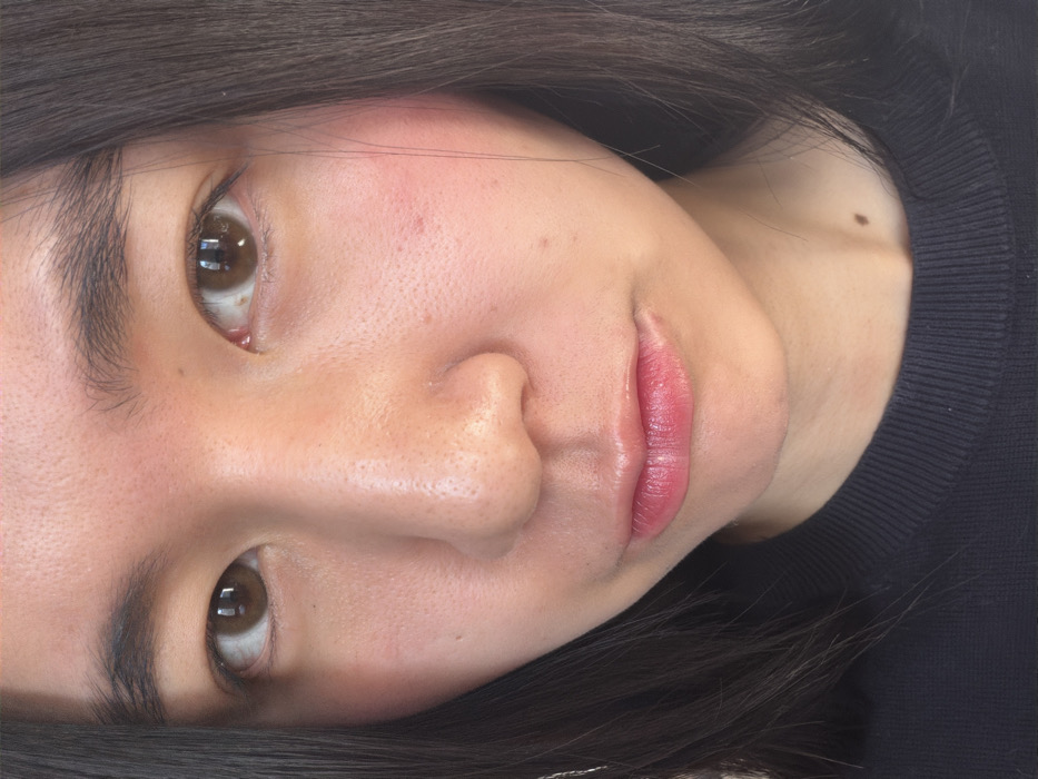 This is a close-up portrait of a single individual, appearing female, featuring her face and upper chest. She has dark, straight hair that frames her face, light brown eyes looking directly forward, and full, dark eyebrows. Her skin is fair, exhibiting visible pores, and subtle redness is present on her cheeks. Her lips are full, a pinkish color, and slightly parted in a soft pout. A small, dark mole is visible on her neck, just above her clavicle. She is wearing a dark, likely black, crewneck garment with a visible ribbed texture around the collar. The background is uniformly light, out-of-focus, and devoid of any discernible features, indicating an indoor setting with soft, even lighting. The location is Paris, France; however, no specific address or landmark within the city is visible in the frame.