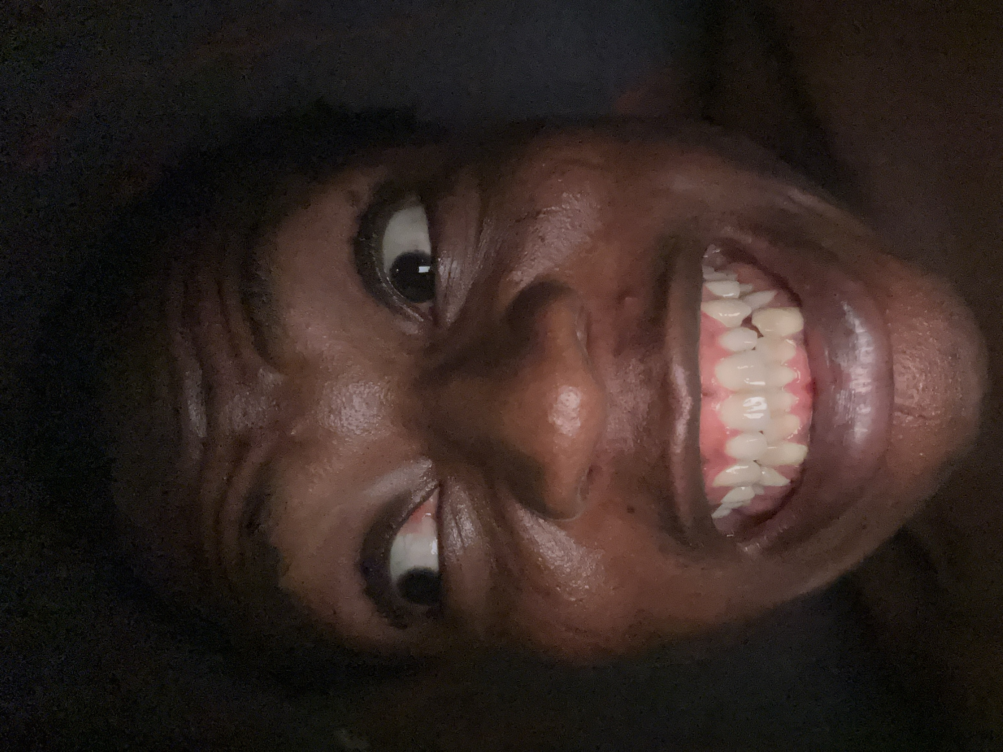 A close-up, angled, and slightly distorted photograph depicts a person's face, tilted counterclockwise. The individual has dark skin and dark hair, with visible facial wrinkles, particularly around the eyes and forehead. The eyes are open, with dark pupils, and one eye appears to be looking upwards. The person is smiling broadly, exposing a full set of white teeth and pink gums. The environment is dark, with the edges of a black garment or background visible around the perimeter of the face.