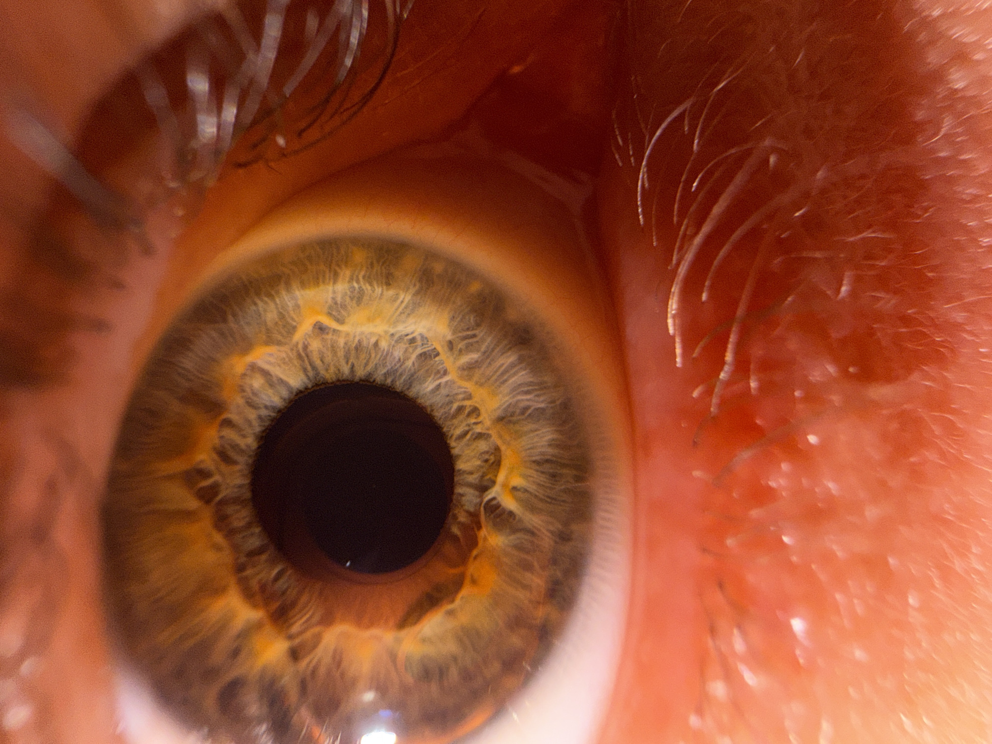 This is an extreme close-up, macro photograph of a human eye. The iris is a striking hazel color with brown and gold flecks, featuring intricate radial patterns. The pupil is a deep black, indicating a dark environment or constricted pupil. The surrounding skin is reddish-orange, with visible pores and fine hairs, likely eyelashes and eyebrow hairs, appearing in the foreground and blurred background. The lighting suggests a direct, artificial source, creating highlights on the skin and the wet surface of the eye. The image is sharpest on the iris and pupil, with depth of field rapidly decreasing towards the edges. There is no discernible location in Bangkok, Thailand, as the image focuses solely on the biological detail of an eye.