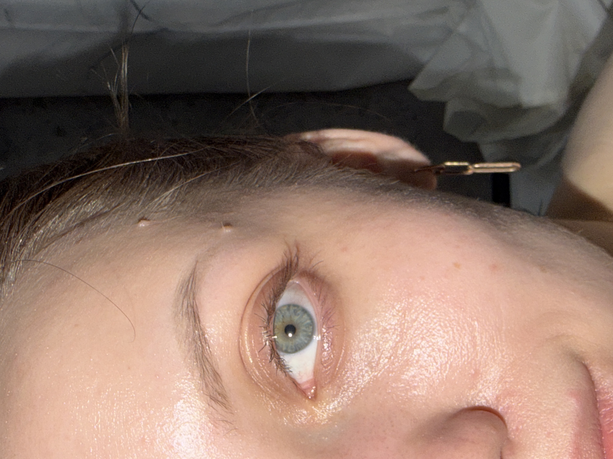 A close-up, partially angled view of a person's face, cropped above the forehead and below the nose. The person's left eye is visible, appearing light blue or green. The eyebrow above the eye is light brown. A few moles are visible on the forehead. Stray hairs are visible above the forehead. A gold-colored bobby pin is located near the person's ear. The skin appears pale and slightly shiny. The background consists of light and dark gray tones, potentially indicating bedding or a wall. There is no information to confirm that this image was taken in Reshetnikovo, Russia.