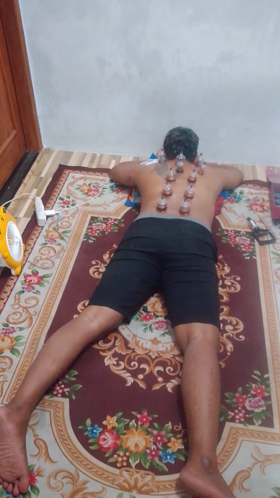 The image shows a person lying prone on a rug with cupping therapy applied to their back. Several glass cups are visible on the person's back, arranged in two columns. The person is wearing black shorts. To the left of the person is a small yellow fan connected to a white power adapter. The rug is maroon with floral patterns. The background shows a wall and a wooden door frame. The scene is indoors. The photograph is taken from a slightly elevated angle looking down.