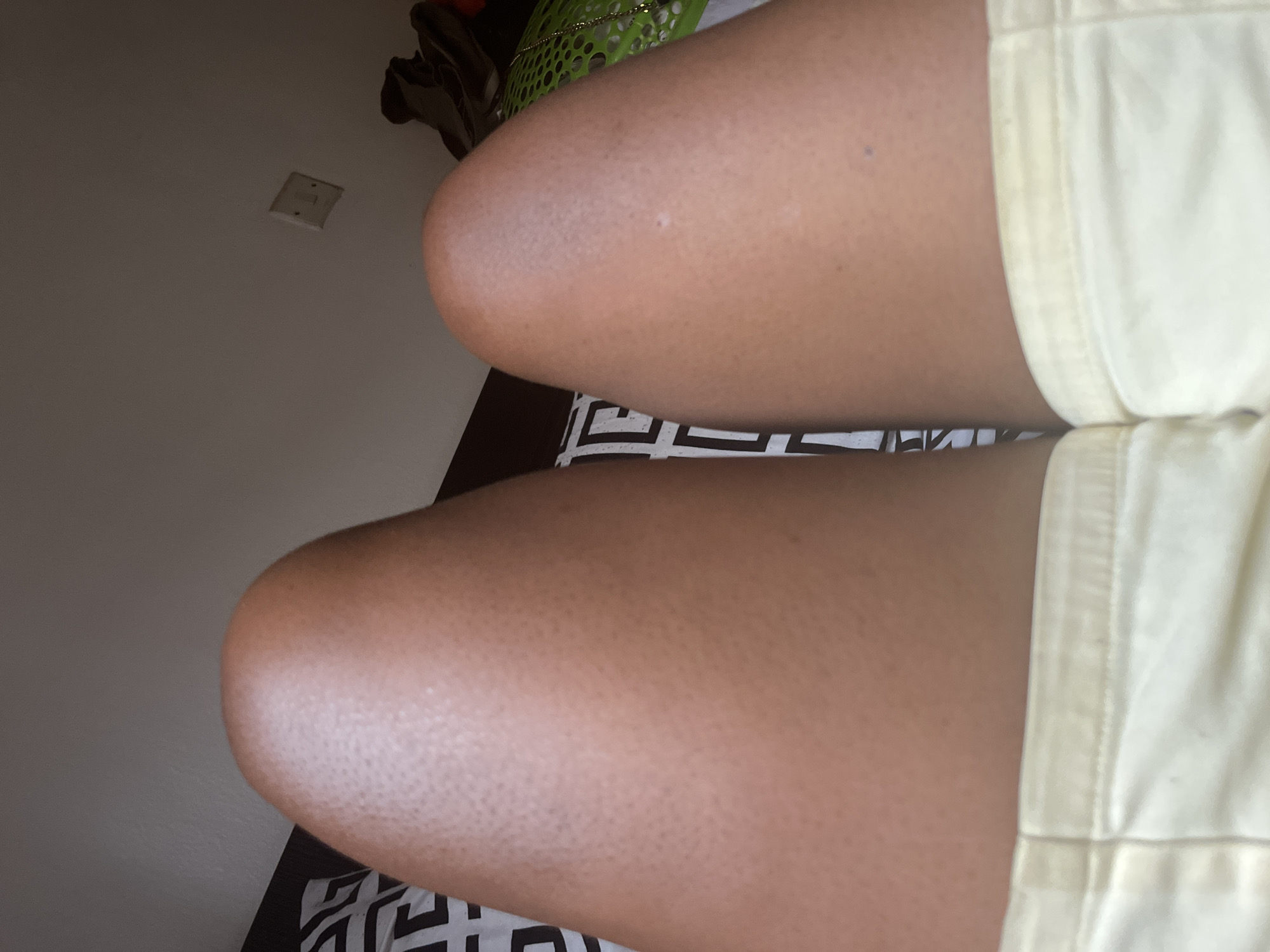 The image shows a close-up view of a person's thighs and legs, covered in tan skin, wearing light yellow shorts. The person is sitting or lying on a bed with a black and white patterned bedspread. In the background, part of a wall is visible, along with an electrical outlet and a green basket. The location is unknown as it cannot be deduced from the image.