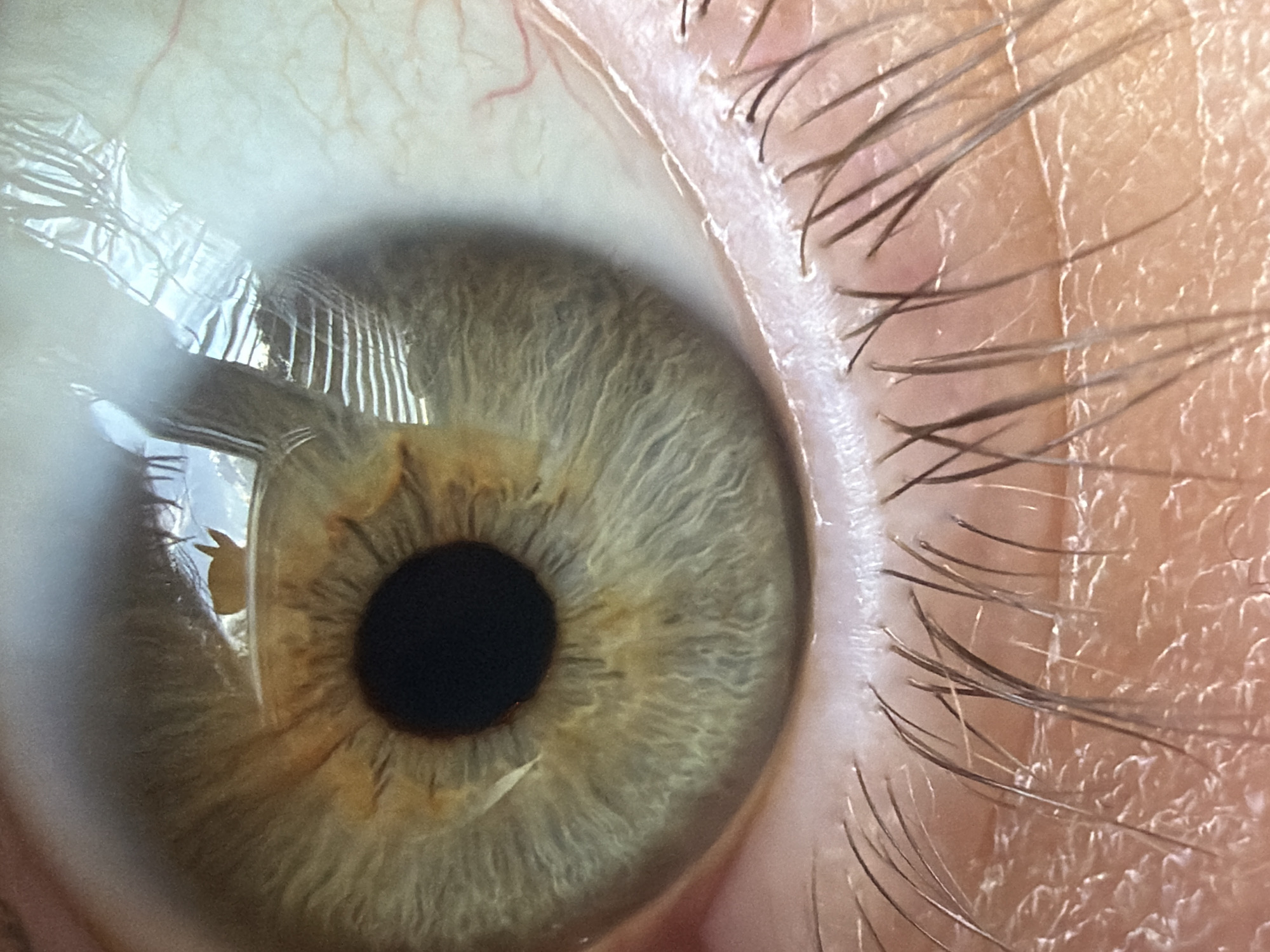The image is a close-up, macro photograph of a human eye, focusing on the iris and eyelashes. The iris is a complex pattern of greenish-brown and yellow fibers. The pupil is a dark, circular opening in the center of the iris. The reflection in the eye's surface reveals a striped, metallic or glass-like structure, possibly from lighting or an object. The lower eyelid and eyelashes are also visible, with the skin showing pores and fine lines. There are no discernible elements in the image that would suggest a location in Chaikovsky, Russia, or any other specific city. The scene is entirely focused on the biological subject.