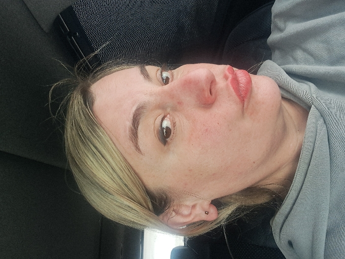 An adult female is depicted in a close-up portrait within the interior of a vehicle, located in the city of Никольское, Russia. The individual has blonde hair, styled away from her face, with several fine, light-colored strands prominent above her forehead. She has fair skin with visible redness and minor blemishes on her cheeks and nose. Her brown eyes, with dark eyeliner on the upper lids, are directed towards the viewer's right. Her lips are pursed into a 'kissing' expression, enhanced with pinkish-red lipstick. She wears a small, dark stud earring in her left earlobe. Her attire includes a grey hooded sweatshirt. The background reveals the dark fabric headliner of the vehicle and a partially visible dark mesh screen, likely a sunshade, on a window to the upper right of the subject. A dark seat or headrest is also partially visible.