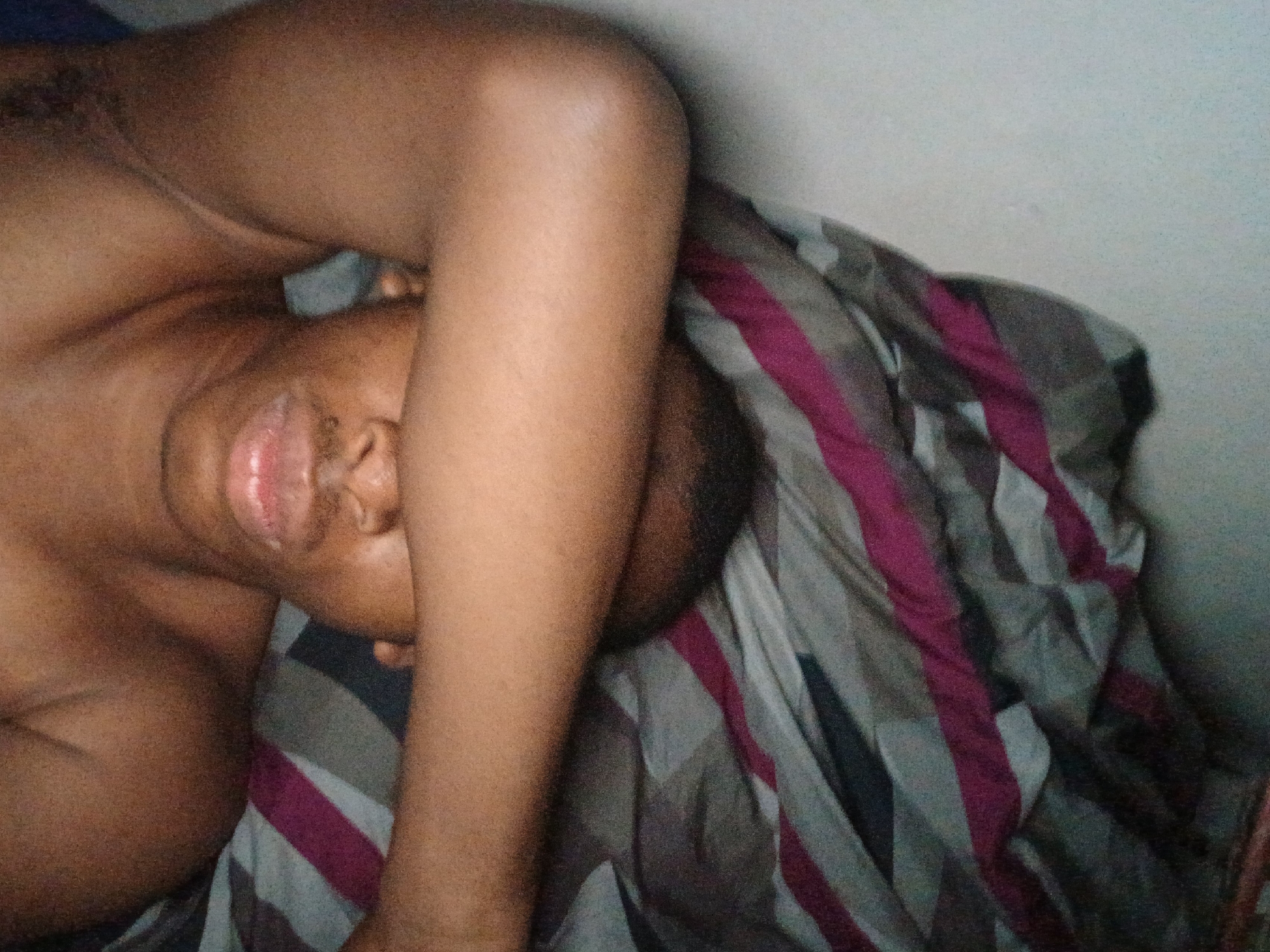 A dark-skinned individual is lying on a bed with striped bedding. The person's arm is raised, covering part of their face. The location is not discernable based on the visual information provided.