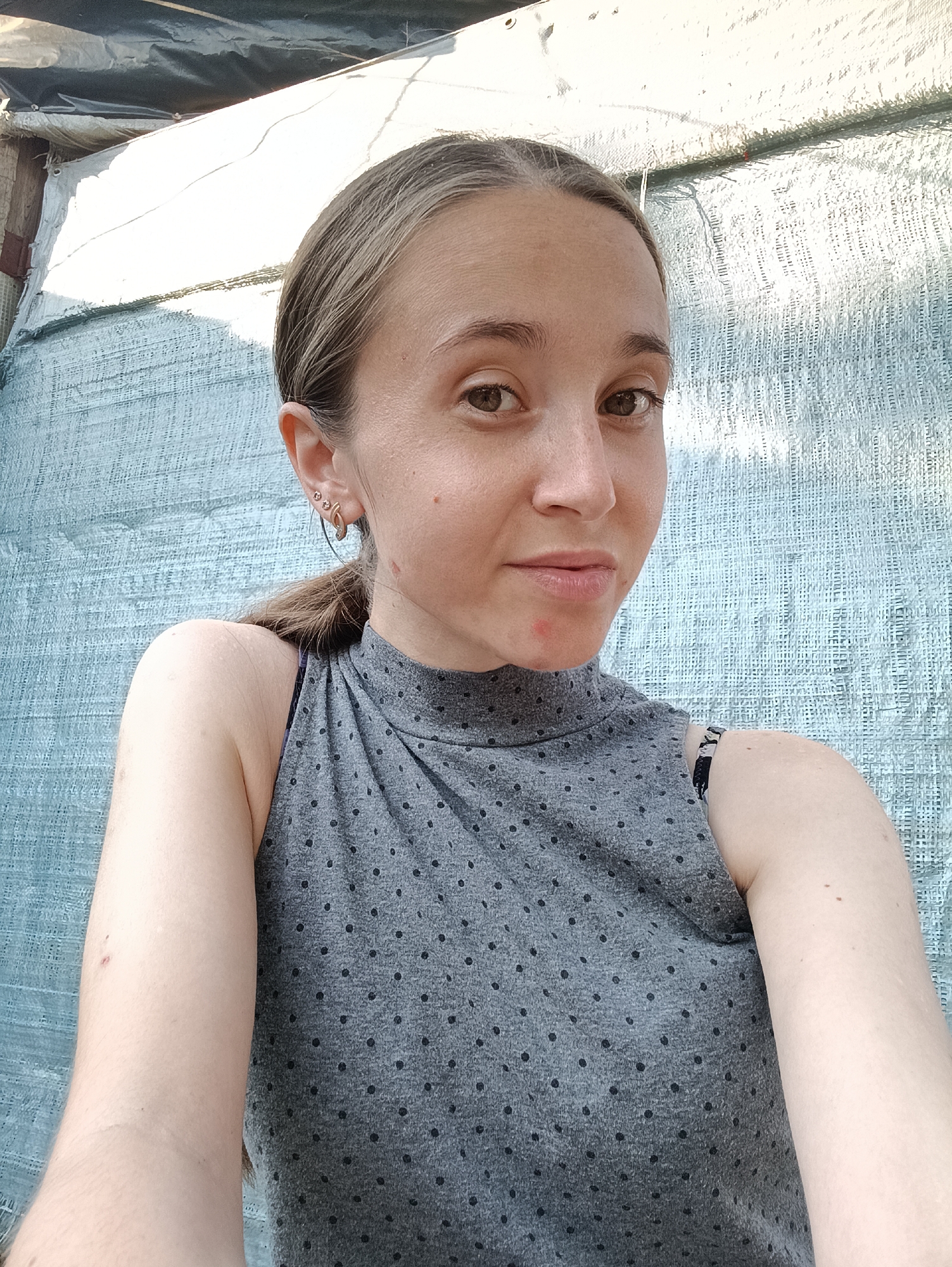 A medium shot captured outdoors shows a young woman with her hair pulled back in a ponytail, facing the camera. She is wearing a grey, sleeveless, high-necked top with a black polka dot pattern. Her skin appears fair with some redness on her cheeks and chin. She has brown eyes and her lips are slightly parted. She is wearing a silver earring in her left ear. The background consists of a light blue tarp or fabric, possibly part of a makeshift shelter, with wooden structures visible in the upper left corner. The lighting suggests it is daytime. The specific location in Vypasne, Ukraine, cannot be determined from the visual information provided in the image.