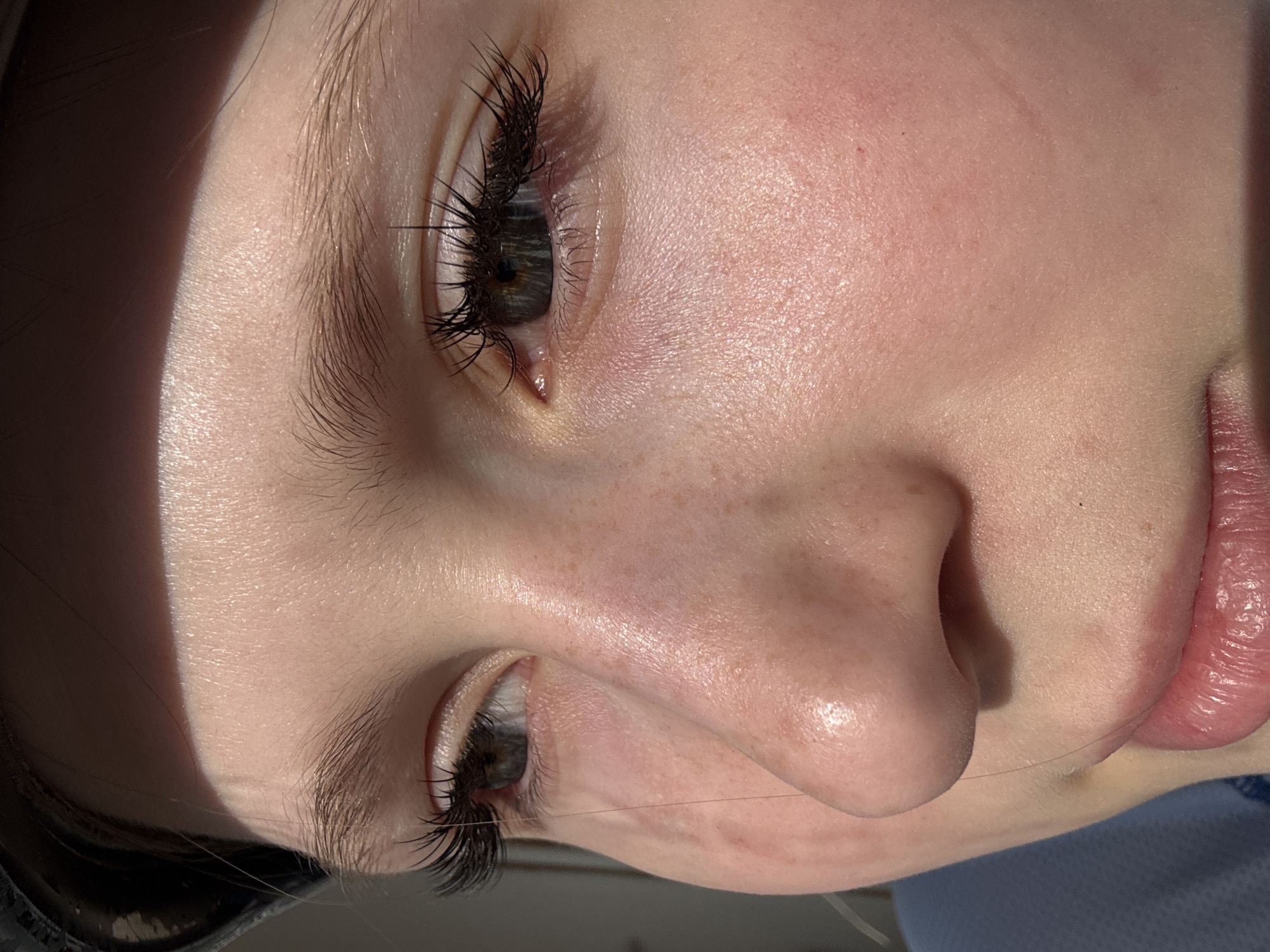 A close-up photograph depicts a portion of a person's face, including the eyes, nose, and mouth. The skin is fair, with freckles visible on the cheek. The eyes are open, exhibiting long, dark eyelashes. There is a strong light source from the upper left, casting a shadow on the forehead. A single strand of hair is visible across the nose and cheek. The lips appear moisturized and pink. The location, Usolye, Russia, is not discernible from this image.