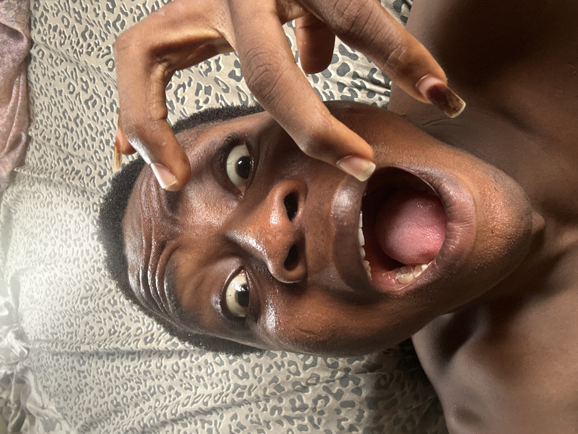 A person with dark skin is lying on a gray and white patterned surface. Their head is tilted back, and their mouth is open, exposing their tongue and teeth. Two fingers from the same hand are positioned on either side of the mouth, as if pulling it open further. The background is blurred, and the person's skin appears slightly shiny. The location and city are unknown.