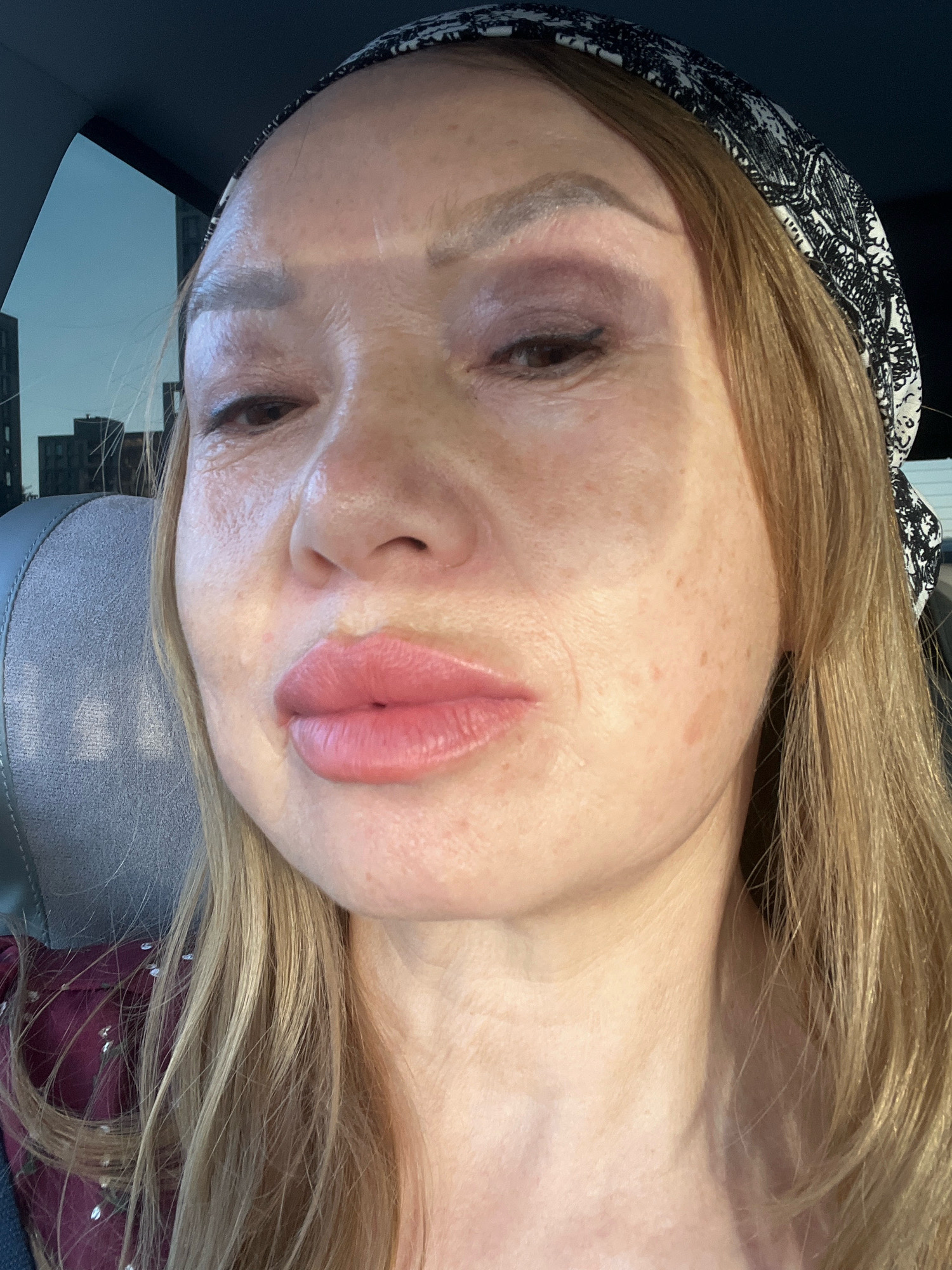 A medium-close-up, frontal, slightly upward-angled selfie shows a woman from the nose up. She is seated in a vehicle, with a gray seat visible to her left and a dark window behind her, framing a distant cityscape with several tall, dark buildings under a hazy sky. The woman has fair skin with some freckles and visible pores. Her eyebrows are thin and light brown, with a darker shadow applied to the left brow area, suggesting makeup or discoloration. Her eyelids appear somewhat swollen, particularly the left eye, which is partially closed. She has prominent, full lips with a light pink lipstick. Her hair is blonde and falls over her shoulders, and she is wearing a black and white patterned bandana on her head. The lighting suggests it is daytime, possibly late afternoon, with some direct sunlight creating a slight sheen on her forehead and cheeks.