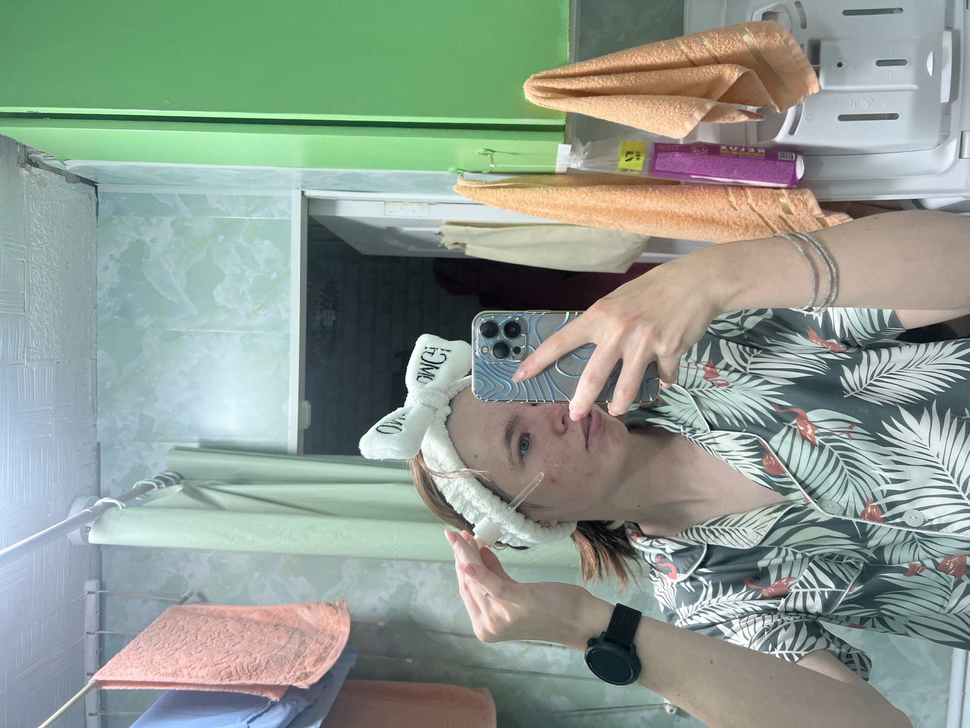 The scene depicts a person, likely female, with reddish-brown hair and visible facial acne, taking a mirror selfie in a bathroom or laundry area located in Chaikovsky, Russia. The person is wearing a white "OMG" bow-shaped headband, a short-sleeved dark green/grey pajama shirt with a tropical leaf and orange flamingo print, a black smartwatch on their left wrist, and multiple silver-colored bracelets on their right arm. They are holding a clear dropper bottle containing a liquid near their face with their right hand, while simultaneously holding a smartphone (identified as an iPhone 13 or 14 Pro series with a clear wavy case) to capture the image.
The background consists of light green patterned wallpaper, a white textured ceiling, and a bright green cabinet or wall section on the right. A white rod runs horizontally across the upper left, from which a light blue and a peach-colored towel are hanging. Another white rod, likely a shower curtain rod, is positioned centrally, holding a light green shower curtain. In the reflected background on the right, two additional peach-colored towels are hanging, one on a green hook and another on a white hook from which a clear plastic bag containing a purple bottle with partially visible Cyrillic text (e.g., "АТИ", "БЕЛОХ") is suspended. Below the hanging items, a white plastic unit, possibly part of a laundry appliance or storage, is visible. A white door is reflected ajar to the right of the person's head.