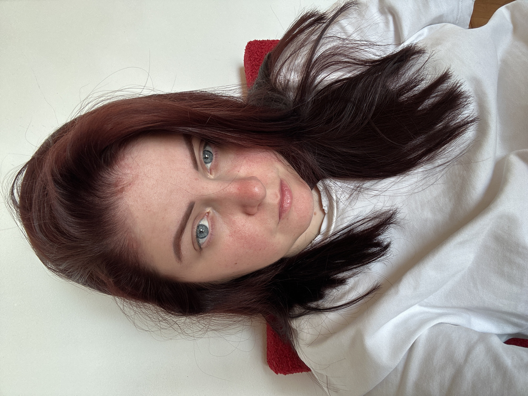 A woman with auburn hair and blue eyes looks directly at the camera, with her face taking up most of the frame. She is wearing a white sweatshirt. Her skin appears red and irritated, particularly on her cheeks and nose. She is sitting on a red object, possibly a chair or cushion, against a white background. The scene appears to be indoors. There is no discernible indication of the location being in the city of Rijeka, Croatia.