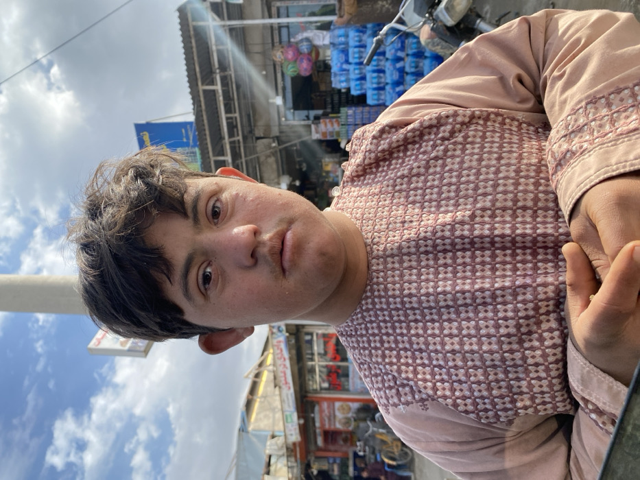 A young male, appearing to be in his late teens or early twenties, is depicted in a close-up on a commercial street in Kandahar, Afghanistan, under a partially cloudy daytime sky. He has dark, unkempt hair, a light mustache, and facial features consistent with Down Syndrome, including almond-shaped eyes and a flattened facial profile. He wears a light brown or dusty rose-colored traditional tunic (likely a *shalwar kameez* top) adorned with intricate geometric embroidery in a lighter hue across the chest and on the cuffs. His hands are clasped together in front of him as he looks directly into the camera with a neutral expression.
The background reveals a bustling urban environment. To the subject's left, a building with an awning features signage in Farsi/Dari script, including "Wahidi" and "Pharmacy," suggesting a drugstore. A tall, light-colored utility pole stands prominently. Further left, blurred figures and a yellow bicycle are faintly visible. To the subject's right, another open-front shop displays multiple stacks of blue bottled water and a cluster of colorful balloons near its entrance. A section of a motorcycle, including a handlebar and mirror, is partially visible in the lower right foreground. Sunlight illuminates the scene, casting some glare and lens flare on the right side of the image.